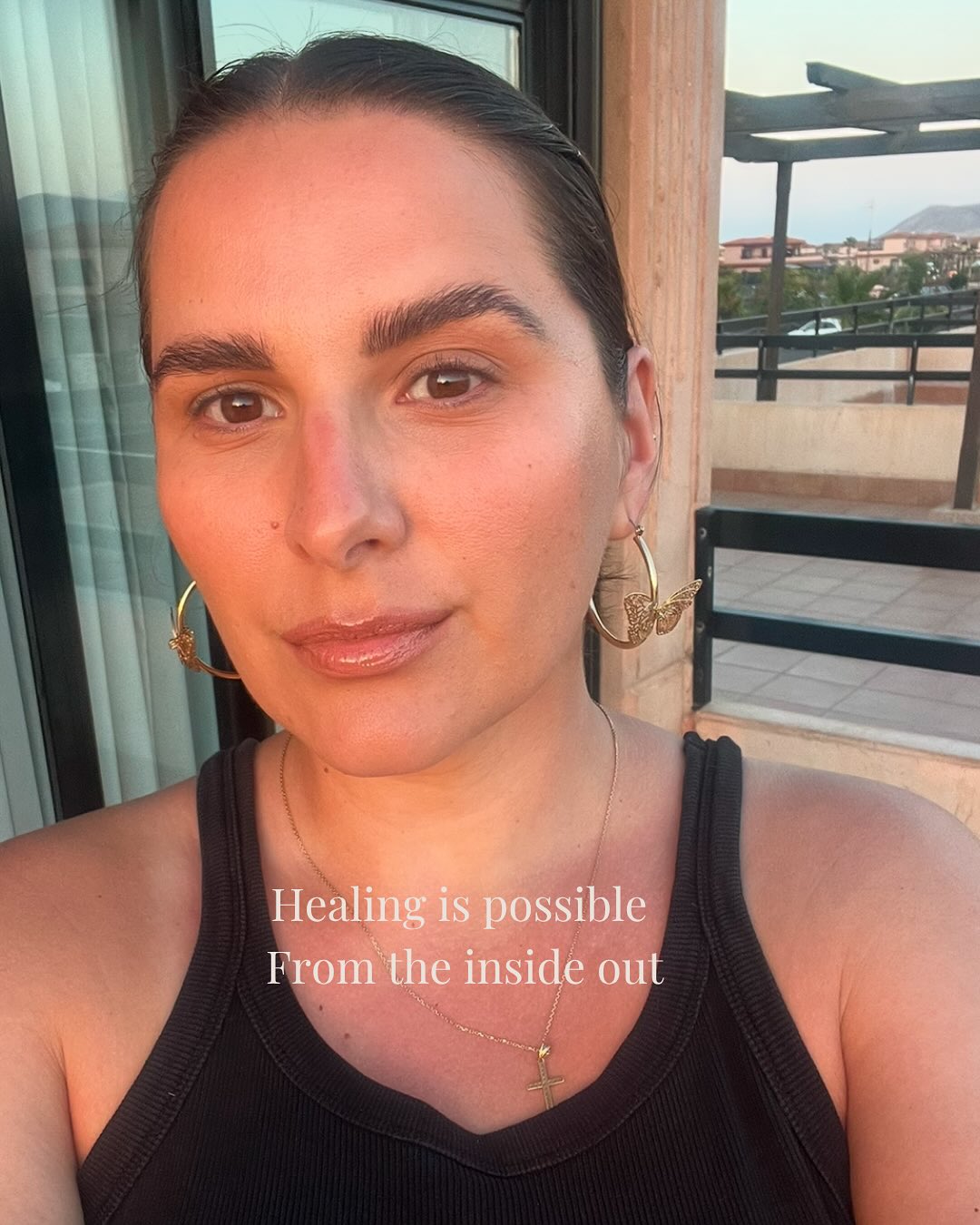 People often say: You wouldn’t understand!
But trust me! I DO! 🫶
I’ve felt the pain, the self-doubt, and the urge to hide behind filters and makeup. I’ve been the skin specialist with breakouts. The woman desperately praying for healing inside and out. ❤️🩹
Healing my own skin changed everything including my mental health and well being and now, I’m here to help you do the same.
Let’s rebuild your skin and your confidence together. 💛
(From one sister to another THAT KNOWS)!
Click on the book now link on our homepage
☎️ 01483715001
📧 info@laurenelizabethmedispa.co.uk
📲 download our app Lauren Elizabeth Medispa
#SkinHealingJourney #SkinConfidence #AdultAcneSupport #medispa #woking #skin #clinic