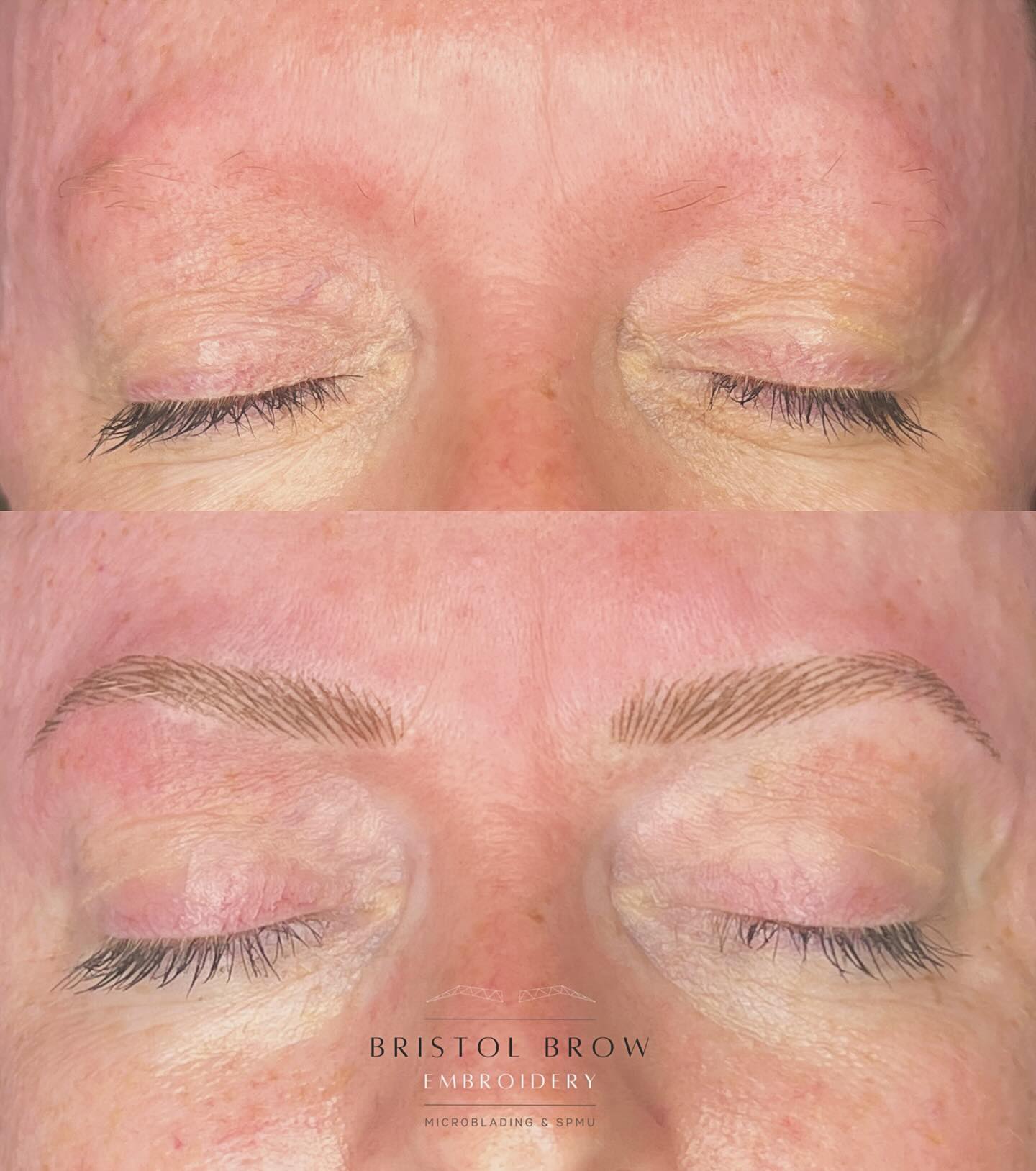 NANO BROW Transformation for Ruth ❤️❤️
__________________________
🗓️ BOOK NOW - Link in Bio (this shows next Availability)
🌐 Further Information on Services & Prices at www.bristolbrowembroidery.co.uk
🏡 Home-Based Studio in Westbury-on-Trym, Bristol
⭐️ Five Star Google Reviews
💬 DM or Text 07920575556 with further enquires
________________________
#hyperrealismbrows
#hyperrealistic #homebasedstudio #bristolmicroblading #bristolbrowembroidery #semipermanentmakeup #microbladingbristol #browsonfleek #bristolbeauty #homebeautystudio #bristolmakeupartist #browtransformation #semipermanentbrows #bristolglam #microbladinguk #homesalon #naturalbrows #sculptedbrows #bristolbeautyservices #bristolbeautytherapist #browenhancement #bristolsemipermanentmakeup #nanobrows #bristolnanobrows #naturalbrows