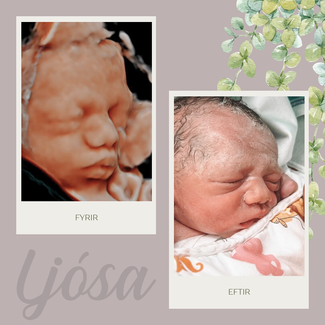 Nýjasti vinur okkar er fæddur 💙
Velkominn í heiminn 🥹