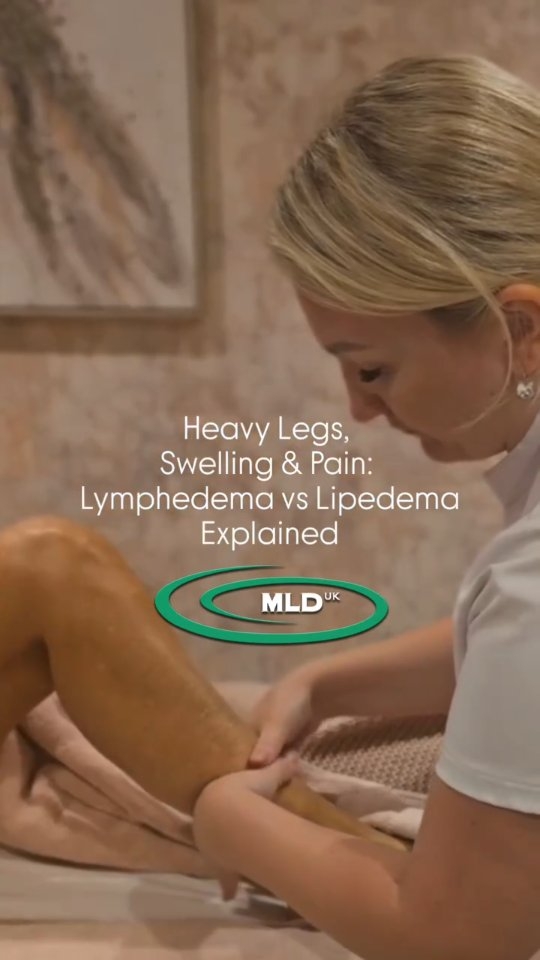 💧 Lipoedema vs Lymphedema: Know the Difference + How MLD Helps
Both Lipoedema and Lymphedema cause swelling and discomfort — but they’re not the same, and understanding the difference helps you find the right care. 💙
💠 Lipoedema
• A chronic fat disorder causing painful, symmetrical swelling (usually in the legs, hips, or arms).
• Fat cells trap fluid, leading to tenderness, heaviness, and easy bruising.
• Often mistaken for obesity — but it’s not caused by diet or inactivity.
💧 Lymphedema
• Caused by a damaged or blocked lymphatic system, leading to fluid buildup and swelling.
• Usually affects one limb more than the other.
• Can cause skin thickening, heaviness, and recurring infections.
✨ How Manual Lymphatic Drainage (MLD) Helps
MLD is a gentle, rhythmic technique designed to:
🌿 Stimulate lymph flow and reduce swelling
💆♀️ Relieve pain, pressure, and sensitivity
🩵 Improve tissue health and circulation
🌸 Promote relaxation and emotional wellbeing
With regular MLD — combined with compression, movement, and good self-care — you can experience:
✅ Lighter, more comfortable limbs
✅ Reduced swelling and pain
✅ Improved mobility and energy
✅ A renewed sense of wellbeing
💧 Lipoedema and Lymphedema are often misunderstood, but awareness is the first step toward healing.
💆♀️ Book your session today with Tatjana and give your body the care it deserves. 🌿
#LipoedemaAwareness #LymphedemaAwareness #ManualLymphaticDrainage #LymphaticMassage #LymphaticTherapy #HolisticHealing #LymphaticHealth #LipoedemaSupport #LymphedemaCare #WellnessJourney #SelfCareStartsHere #TatjanaSenkova