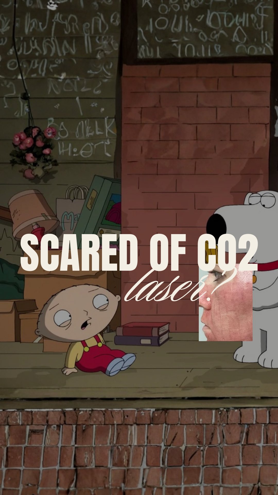 Je bent vast net als Stewie…een beetje bang voor de CO2 laser? 😳
Begrijpelijk… het klinkt heftig.
Maar geloof ons: NIETS geeft zulke resultaten.
De meest angstaanjagende behandeling,
met de beste resultaten ooit😍
Onze meest geboekte behandeling en dat is niet voor niets.
95% huidverbetering. Fijnere poriën. Egalere textuur. Pure glow.
Na de Nova CO2 wil je nooit meer iets anders. ✨
⚡️ Alleen in oktober:
Full Face €449 (ipv €599)
📲 Boek nu, vóór de oktoberplekken vol zijn.
📅 Boek online: www.thehagueclinic.nl
📞 Bel: 085 060 74 77
📧 E-mail: info@thehagueclinic.nl
LIKE, SAVE & FOLLOW als jij klaar bent voor jouw huidtransformatie.
🤍 @thehagueclinic
#co2laserdenhaag #co2laseramsterdam #co2laserrotterdam #huidkliniek #huidkliniekdenhaag #bestebehandeling #fractionallaserco2 #co2lasernederland