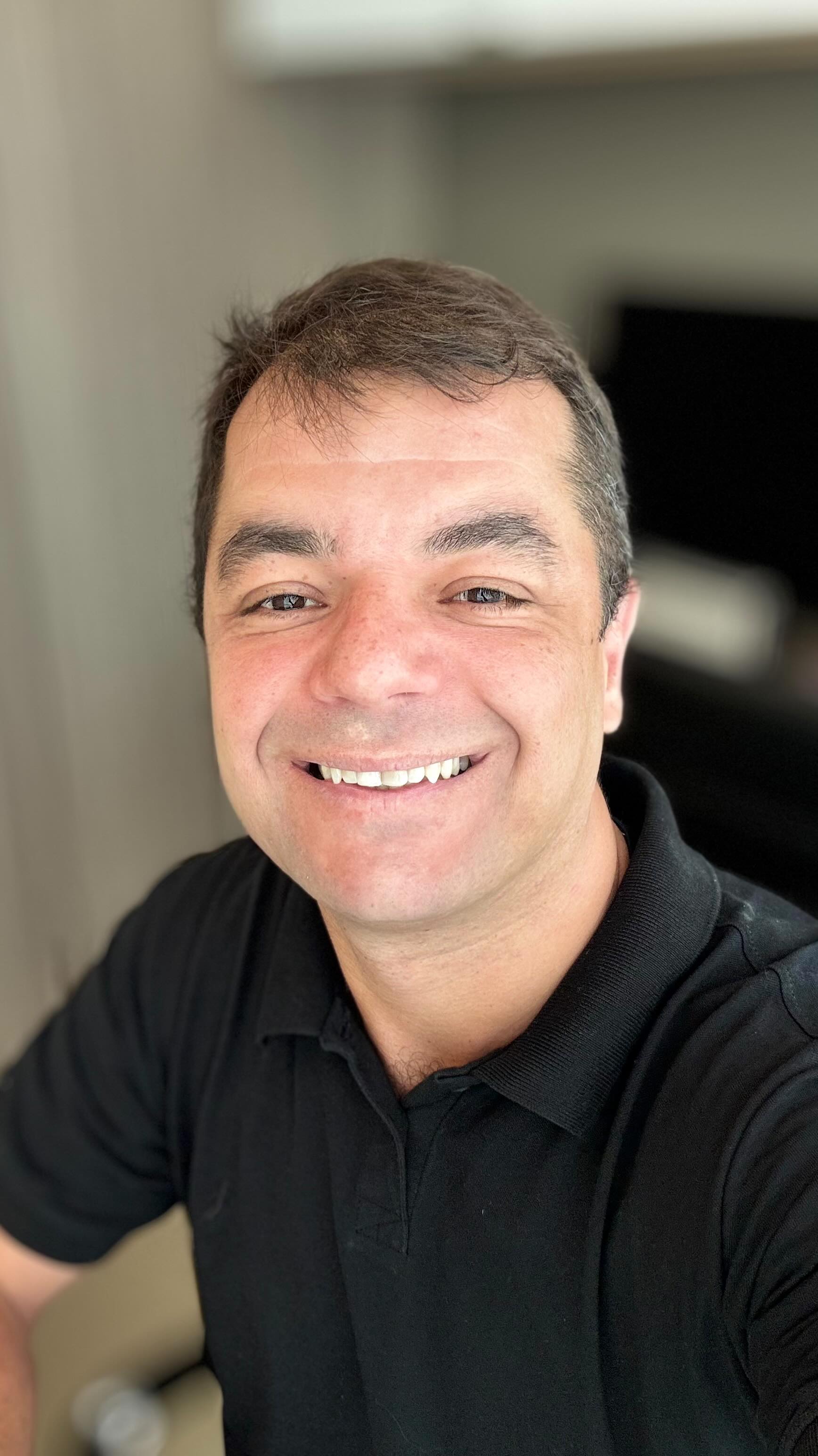 FERIDAS NAS PERNAS E NOS PÉS podem indicar doenças vasculares descompensadas. Se você ou algum familiar tem alguma ferida que não cicatriza, é importante a avaliação médica antes de qualquer complicação maior. #cirurgiavascular #saudevascular #pediabetico #diabetes #tabagismo