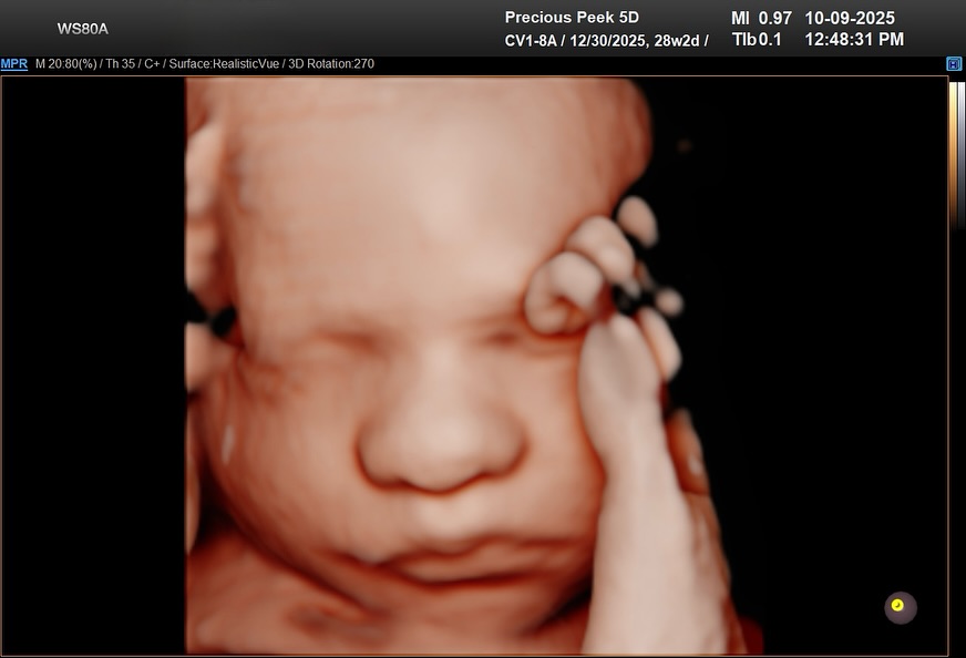 december & january due dates; now is the time to schedule your 4D5D session ❤️