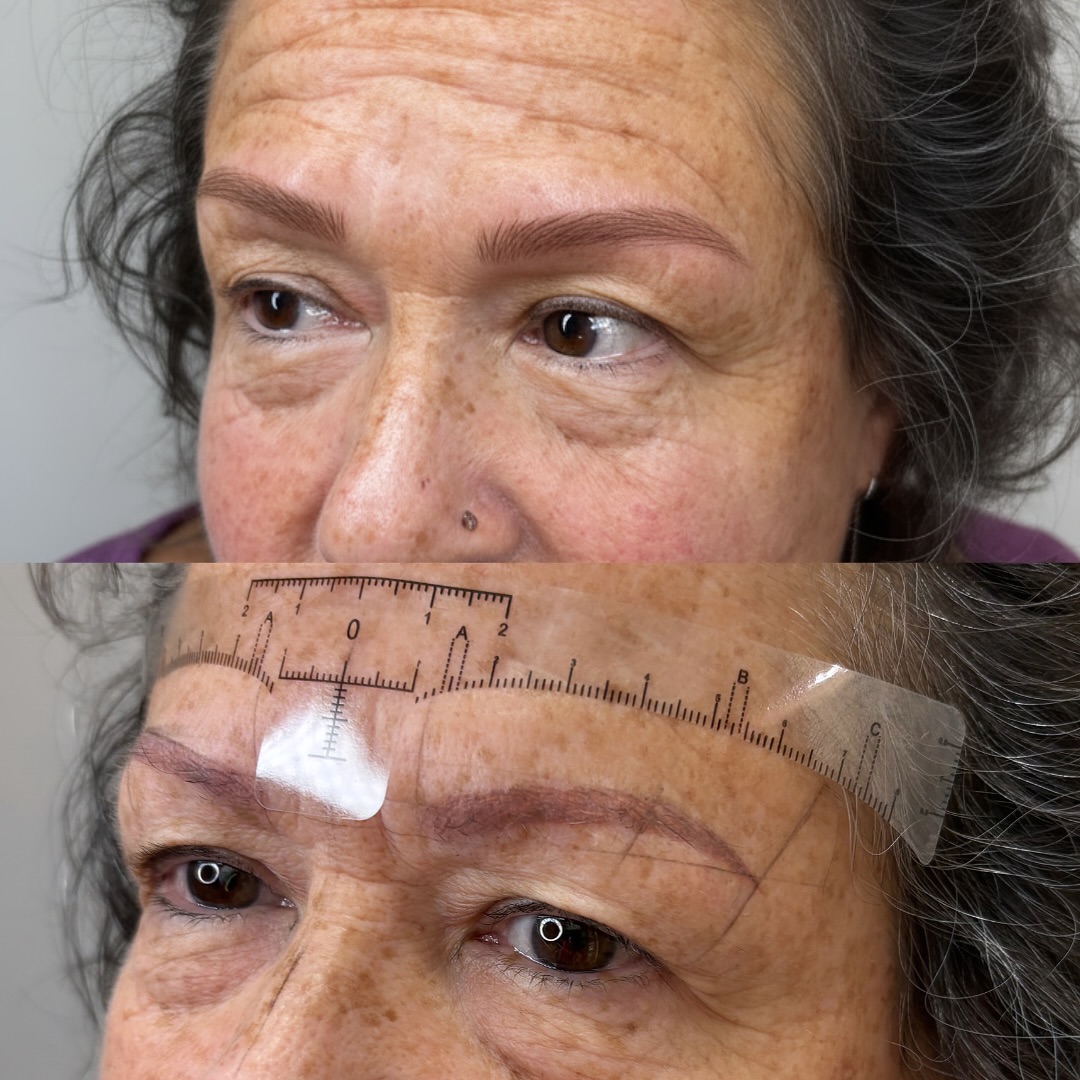 ✨ Nano Microblading Transformation ✨
Our lovely client came in with old red–purple brows. Without doing a full removal and multiple color collection steps, we performed a one-step color correction and point removal, refined the shape for better symmetry.
We then added super realistic nano hair strokes that she wished.
💫 Her eyes look more open and fresh. How much eyebrows enhance her features!
#NanoBrows #MicrobladingCorrection #ColorCorrection #BrowTransformation #RealisticBrows #NaturalResults #PasadenaBrows #LashesBrowsSkinClinic