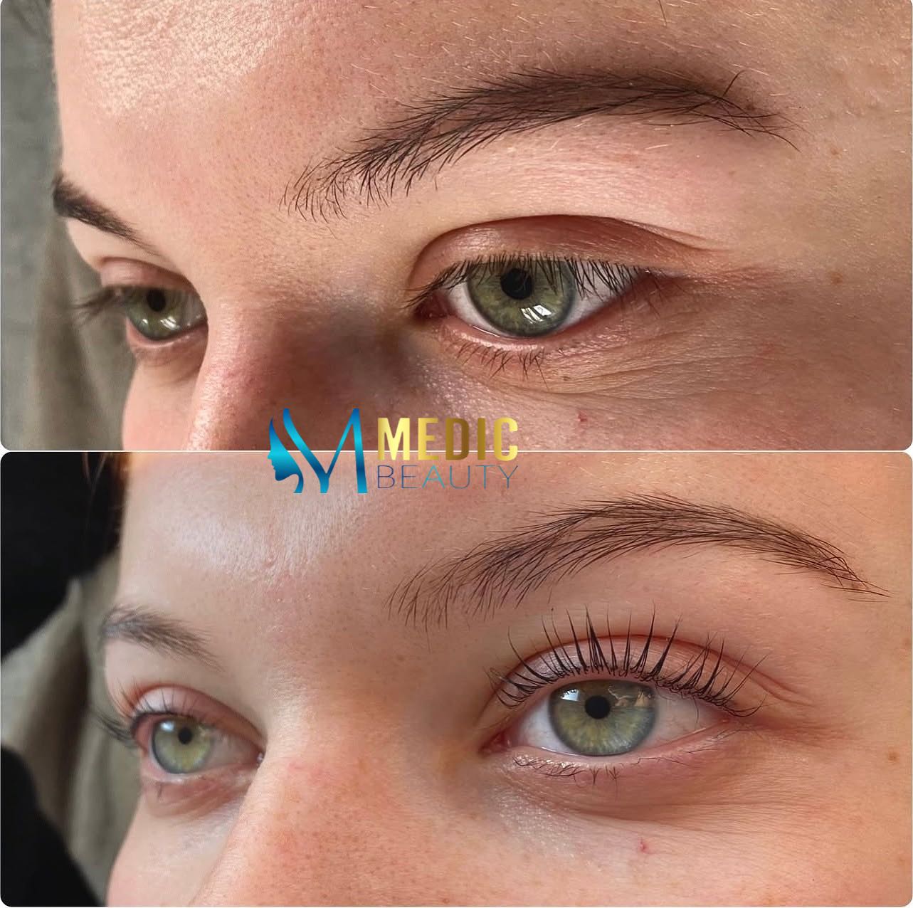 Låt oss hjälpa dig framhäva din egna skönhet 🪄 En naturlig och fantastiskt fin lashlift med Keratin boost för att skydda fransar och bibehåll långvarig effekt😍 Välkomna till Medic Beauty i Borås🌸
#lashliftborås #lashlife #boråsstad #wow