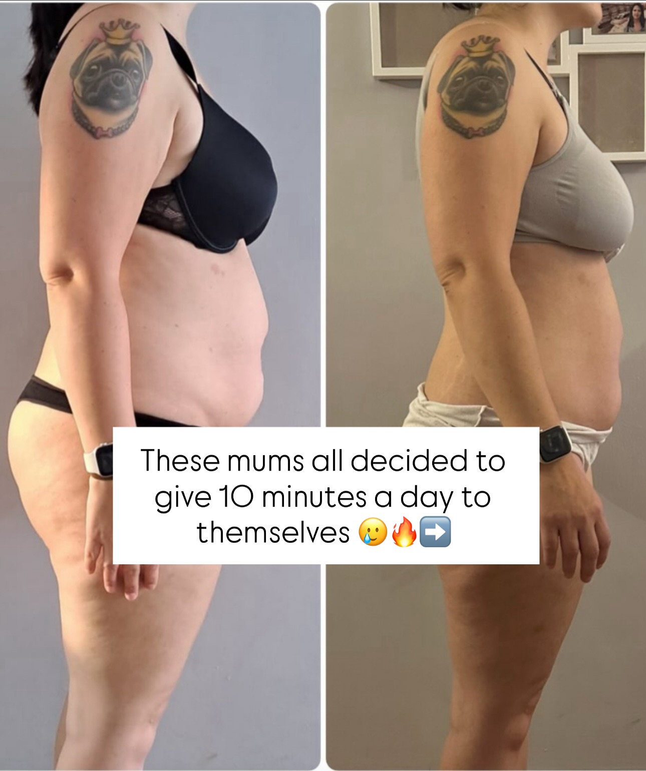 When you realise you can do a 10 min workout most days…
From the comfort of your own home ☺️
Whilst baby naps or toddlers eat or play 🧸
Or when you get back from the school run 🚘 👣
You’re literally just dedicating a small window of time to yourself 🕰️
And that’s all it takes to get ‘on the wagon’ 🎉
Before you know it you’re taking control again 👊
And that feeling makes you want to comfort eat less… and make better choices for yourself ❤️
The results happen and it all falls into place ✨👌👌
Here’s a few pics I’ve been sent over the last couple of weeks, of mums who felt fed up of their body … and now they’re feeling hopeful and positive (& looking 🔥!) 💕
Pop me a msg if you’re struggling … it’s normal to feel this way 🫶
These results are all from using my short online workouts - use the link in bio to join my website!
Or ask me about my new 4 week Core Builder program 💫
#mummymotivation #homeworkoutsformums #mummymotivation #fitnessformums #homeworkoutswork #workoutsforwomen #workoutwithkids #postnataljourney #postnatalexercise #perimenopausefitness #mumssuportingmums #katesmumfitclub #legsbumsandbubbas