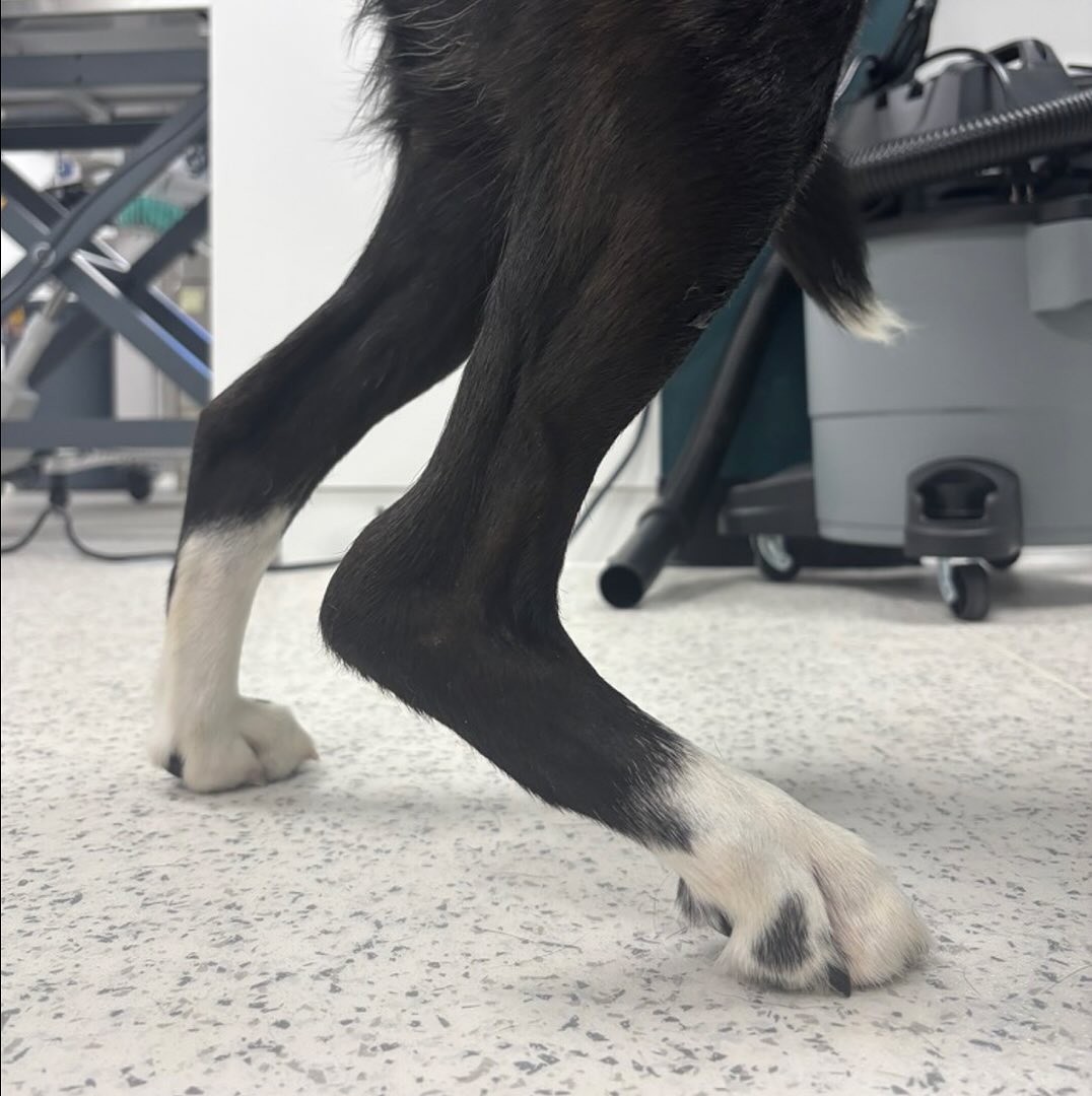 Chronic, partial common calcaneal tendon (Achilles tendon) rupture in a 7 years old, FS Retriever Mix.
———
The common calcanean tendon (Achilles tendon) comprises three main parts: the paired tendons of the gastrocnemius muscle, the combined tendon of gracilis, semitendinosus, and biceps femoris muscles, and the tendon of the superficial digital flexor muscle.
The knuckling or flexion of the digits is a characterisitic clinical sign associated with partial disruption of the common calcanean tendon. It results from the intact tendon of the superficial digital flexor muscle being stretched taut over the calcaneus in a hyperflexed tarsocrural joint.