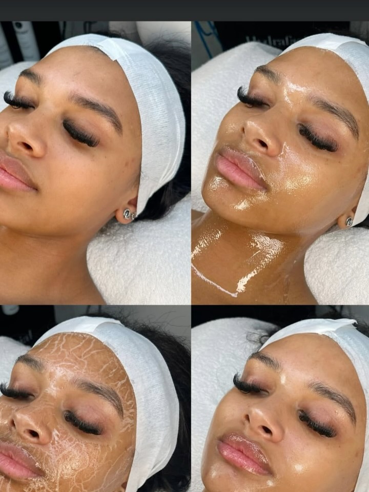🌿 How Peeling Helps Hormonal Melasma
Peeling doesn’t just remove dead skin — it helps to:
✨ Lift surface pigmentation
💧 Speed up cell turnover
🌸 Enhance absorption of brightening ingredients
🌞 Refresh dull, uneven tone caused by hormonal changes
Hormonal melasma can be stubborn — but not impossible.
Professional peeling helps lift pigment, renew the skin, and restore your natural glow 🌸
Every session brings you closer to brighter, more even skin 💫
#CircadiaPeel #MelasmaCare #SkinRenewal #PasadenaFacials