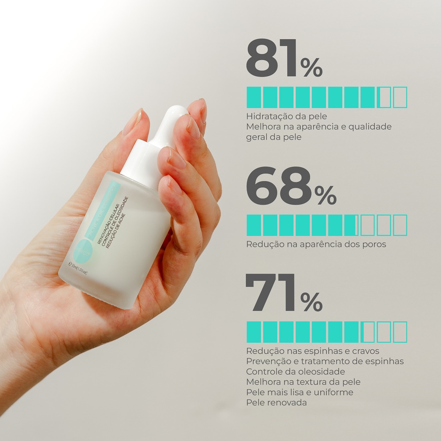 Pele oleosa, com acne e poros dilatados? 😩 Calma, tem solução sim! 💚
O Sérum Acne & Oil Control é aquele produto multifuncional que faz tudo pela sua pele:
✨ Deixa o rosto com textura mais uniforme e lisa
🌿 Controla a oleosidade e combate a acne
🌸 Auxilia no clareamento das manchinhas causadas pela acne
💧 Minimiza os poros sem deixar a pele ressecada
Sabe o melhor? Ele é leve, não pesa, não arde e ainda mantém a hidratação na medida certa. Perfeito pra usar todos os dias e sentir a pele cada vez mais equilibrada e saudável! ✨
Quem disse que controlar a oleosidade precisa ressecar a pele, nunca usou o nosso queridinho 💚
#skincare #peleoleosa #sérumfacialvegano #acnecontrol #pelebonita #rotinadebeleza #belezareal #skincarelovers #pelesaudavel #serumácidolático #cosmeticosnaturais #cleanbeauty