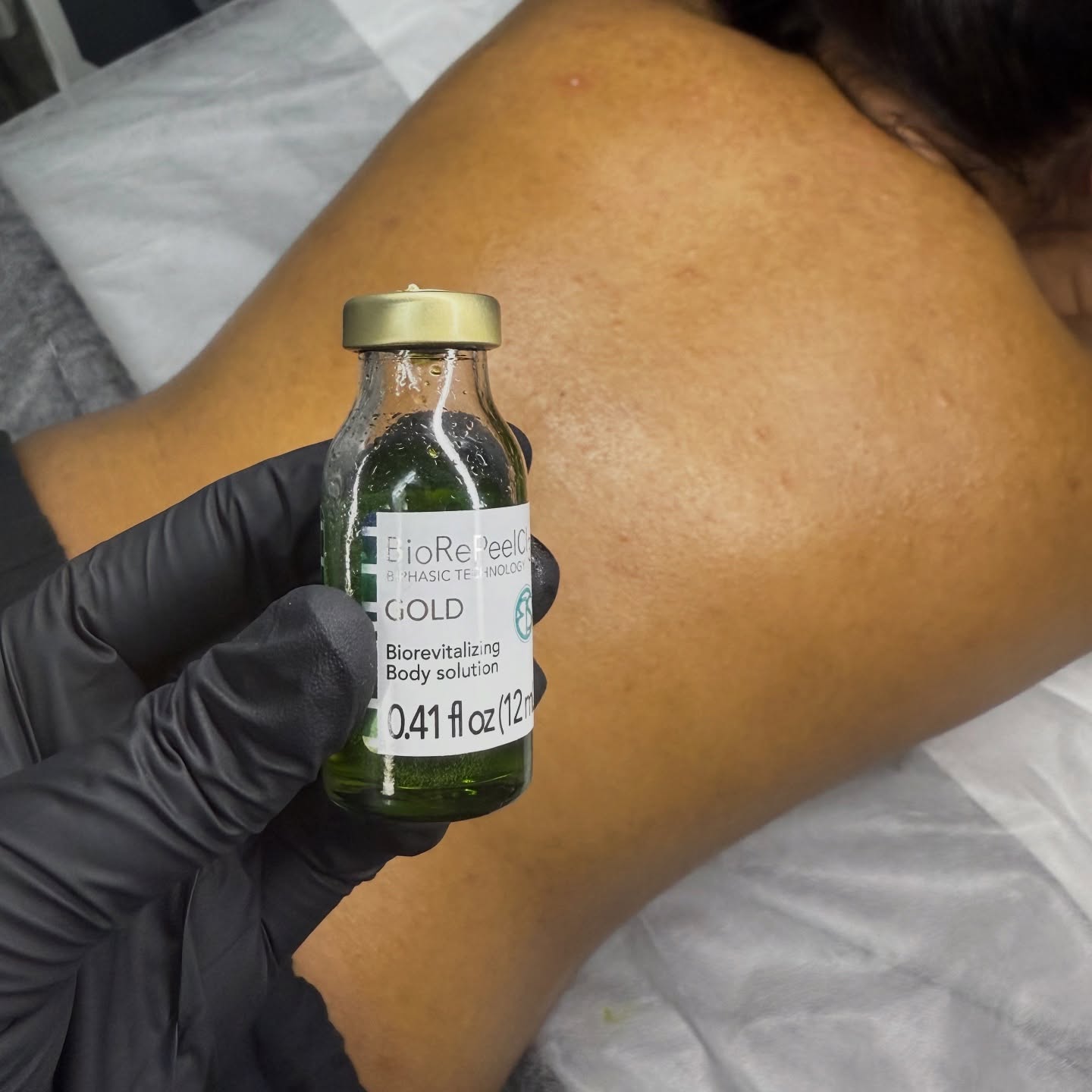 BioRePeel Gold – The Ultimate Glow Treatment!
Give your skin the luxury it deserves with our next-generation Italian peel — BioRePeel Gold
This premium formula goes beyond the surface to revive dull, tired skin, minimize pores, improve texture, and boost collagen production — all with zero downtime!
No harsh peeling, no long recovery — just brighter, smoother, and youthful-looking skin from the very first session.
Perfect for anyone looking to:
💫 Fade pigmentation & acne marks
💫 Smooth fine lines & wrinkles
💫 Restore hydration and glow
💫 Improve skin elasticity and tone
Your skin deserves that golden touch — because glowing, healthy skin never goes out of style
Book your BioRePeel Gold session today and let your skin shine from within
#BioRePeelGold #BioRePeel #GlowingSkin #SkinGlowGoals #LuxurySkincare #AgelessBeauty #HealthySkinJourney #SkinRenewal #RadiantComplexion #SkincareRoutine #SkinGoals #NoDowntimePeel #InstantGlow #FacialPeel #MedspaTreatment #YouthfulSkin #SkincareAddict #BeautyClinic #GlowFromWithin #GlassSkin #SkinConfidence #SkinTransformation #SkincareObsessed