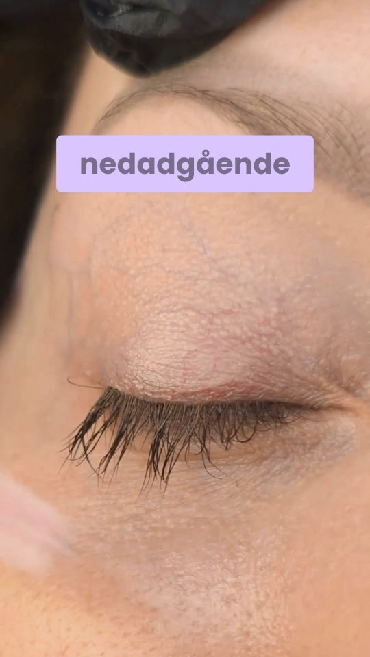 Kraftige, serumpåvirkede vipper, der vokser i flere retninger.
Her tester vi, hvordan Perfect Glue Balm klarer det.
Selv de her krævende vipper sætter sig fast på puden i første strøg og løfter sig ikke igen.
Limen holder vipperne stabilt nede, uden at de slipper, så man kan rede dem igennem og arbejde med dem helt uden problemer.
Man skal bare huske at fjerne overskydende lim.
Og ja – man kan vist roligt sige, at den klarede testen.
Perfect Glue Balm – selv til de mest krævende vipper 🖤