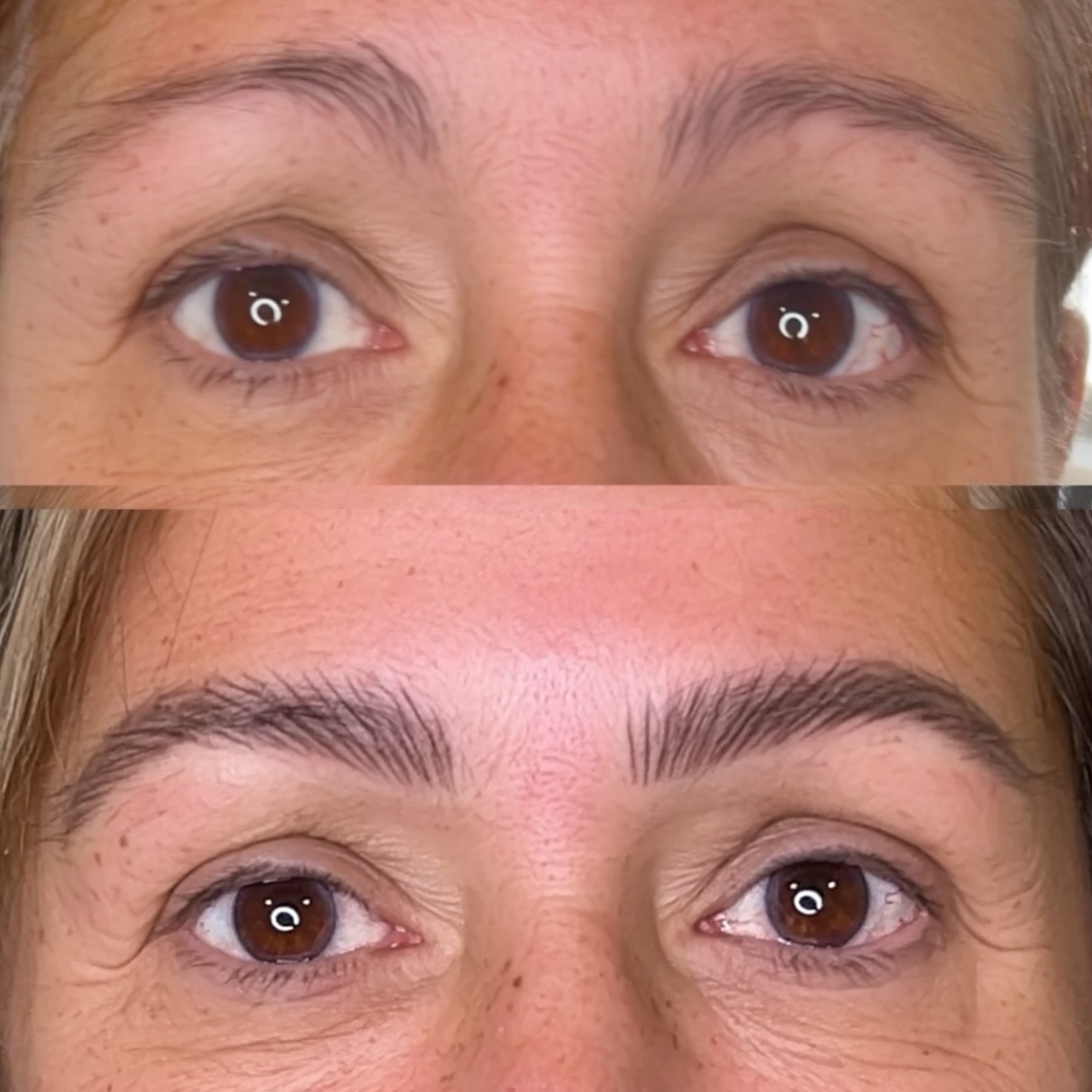 🩷 HYPER REALISM BROW TATTOO GLOW UP 💜
From sad brows to happy lifted brows.
My lovely client had wanted these for ages! She used to have naturally full brows but they’d turned patchy and were quite downturned.
This is right after the second session, they will shrink in size and soften. Hyper realism brows isn’t just a buzz word for cookie cutter hair strokes - these are completely unique to your face and features and they are created like a drawing (my background is art not beauty) they are designed with movement and to fit with the individual way a persons real eyebrows would flow. No blocks, no templates, designed all freehand - just for you because every face is different
Two sessions are needed spaced 5-6 weeks apart. This is immediately after session 2 - no redness or trauma to the skin.
I use a tiny needle and a machine to create natural and lifelike hair strokes that flow like real hairs and are personalised to your face and features.
I draw them on first so you can see the shape I recommend for your face and then I go ahead with the treatment using numbing cream
You can also find more info here on my website
https://www.jorlittle.com/permanent-eyebrow-tattoo
Booking for November and December l now - so message if you’re hoping to complete your brow journey before Xmas as it takes a couple of months from start to finish and I book up quite far ahead.
What’s app me rather than call on 07976 439678 or book on my website where you can also find prices via book now page for Tynemouth & London
www.jorlittle.com
Used @@hanafy_uk pigments and @face.pm @defenderrofficial needles @id_liner_pmu @luna.cartridges @cosmedic_supplies
#hyperrealism #hyperrealismbrows #hyperrealismbrowsnewcastleupontyne #hyperrealismbrowslondon #permanentbrows #permanenteyebrows #fluffymicroblading #nanoblading #fluffynanobrows #eyebrowtattoo #eyelinertattoo