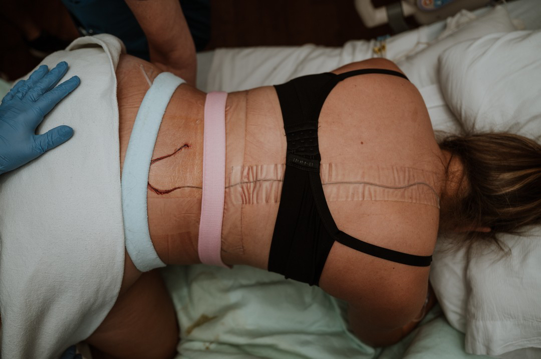 📸 @jennavanloon.doulatog
🌙✨ An Epidural is Not a Failed Birth ✨🌙
There is no one “right” way to walk through the fire of labor.
Some birth stories involve deep breathing, candles, and warm water.
Some unfold in a softly lit hospital room, with an epidural, steady rhythms, and a team holding space.
All of them are valid. All of them are sacred.
Choosing pain relief doesn’t mean you weren’t strong.
It doesn’t mean you didn’t “do it right.”
It means you listened to your body and your intuition.
And that is power.
Let’s stop measuring worth by how much we endure.
Let’s honor every way the portal opens. 🌹🕯️
✨ You are a force of nature.
✨ A vessel of ancient magic.
✨ A mother, in all your power.
#SacredBirth #WitchyBirthWorker #ConsciousBirth #EmpoweredBirth #BirthWithoutJudgment #EpiduralIsBirth #DoulaHeatherTaylor #MysticalMama #GroundedFeminine #BirthIsSpiritual #RiteOfPassage #EpiduralSupport #DivineFeminineEnergy #IntuitiveMothering #ModernWitchVibes