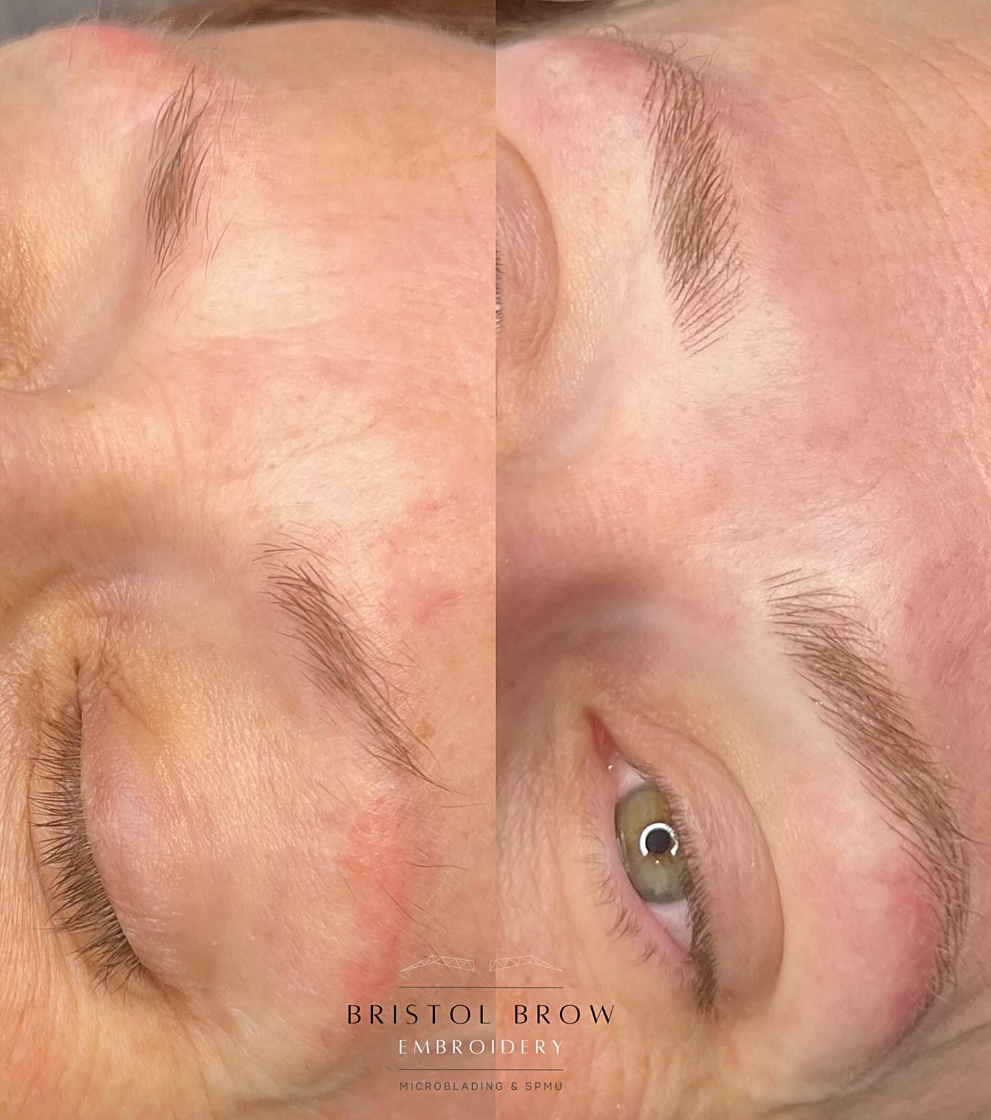 Gorgeous soft, Blonde Nano’s for Beverley 🫶🫶🫶
_______________________
🗓️ BOOK NOW - Link in Bio (this shows next Availability)
🌐 Further Information on Services & Prices at www.bristolbrowembroidery.co.uk
🏡 Home-Based Studio in Westbury-on-Trym, Bristol
⭐️ Five Star Google Reviews
💬 DM or Text 07920575556 with further enquires
_________________________
#hyperrealismbrows
#hyperrealistic #homebasedstudio #bristolmicroblading #bristolbrowembroidery #semipermanentmakeup #microbladingbristol #browsonfleek #bristolbeauty #homebeautystudio #bristolmakeupartist #browtransformation #semipermanentbrows #bristolglam #microbladinguk #homesalon #naturalbrows #sculptedbrows #bristolbeautyservices #bristolbeautytherapist #browenhancement #bristolsemipermanentmakeup #nanobrows #bristolnanobrows #naturalbrows