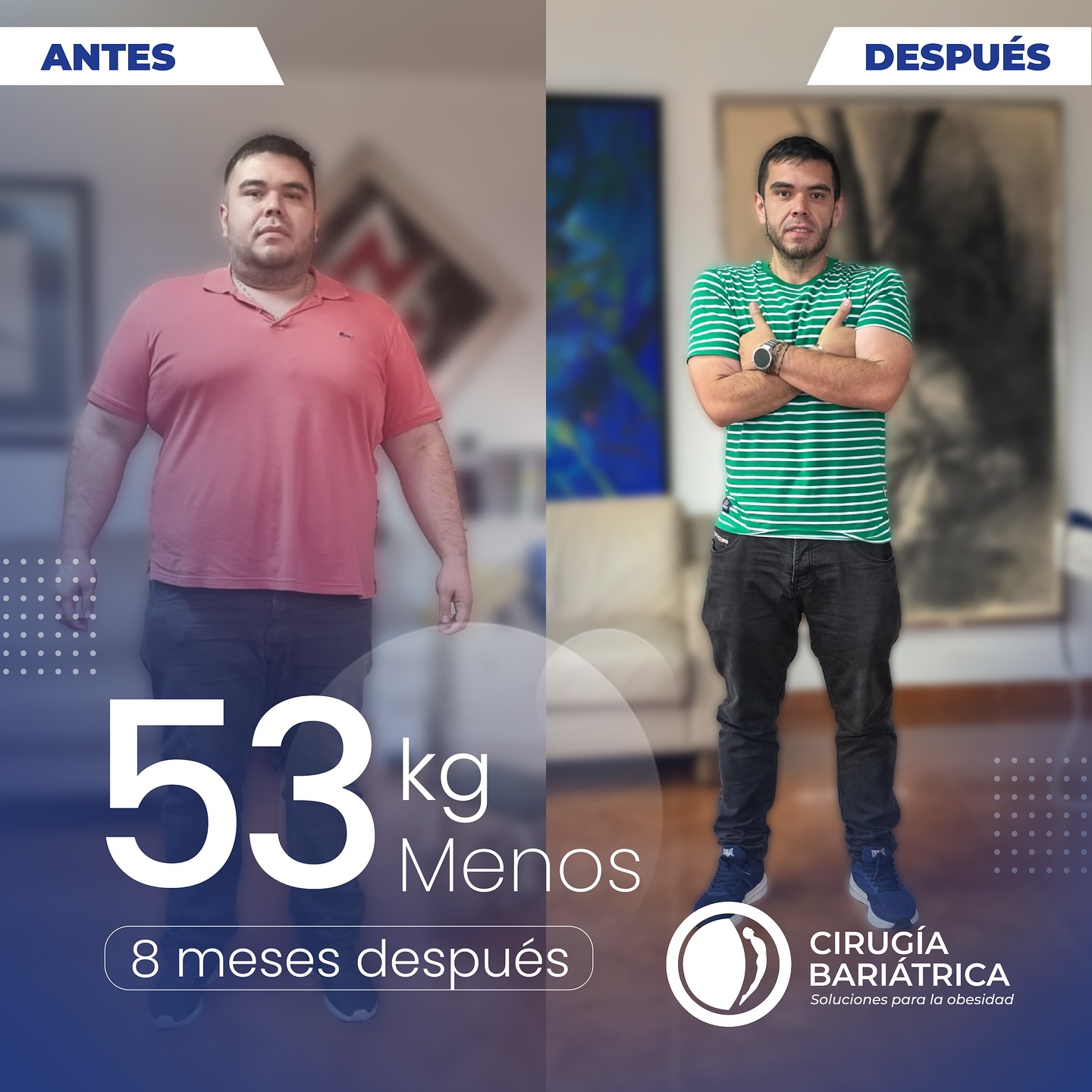 ✨ En solo 8 meses logró perder 58 kilos gracias a la cirugía bariátrica realizada por el Dr. Eduardo Bolaños y su equipo de trabajo. 💪
Una transformación que refleja disciplina, salud y una nueva oportunidad de vida. 💙
✨ In just 8 months, the patient lost 58 kilos (128 lbs) thanks to the bariatric surgery performed by Dr. Eduardo Bolaños and his dedicated team. 💪
A transformation that reflects discipline, health, and a new chance at life. 💙
#health #healthy #healthandwellness #weightlosssupport #weightlossjourney #bariatrica #bariatric