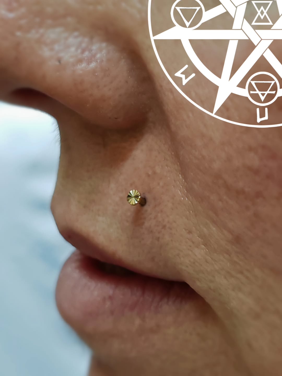 Fresh upper lip piercing from few weeks ago, featuring Lazer Disk from @buddhajewelryofficial
Piercer: @symbiotic_piercing @paid2stab
Using: @probodyart @purklenz
Aftercare: @neilmedpiercingaftercare