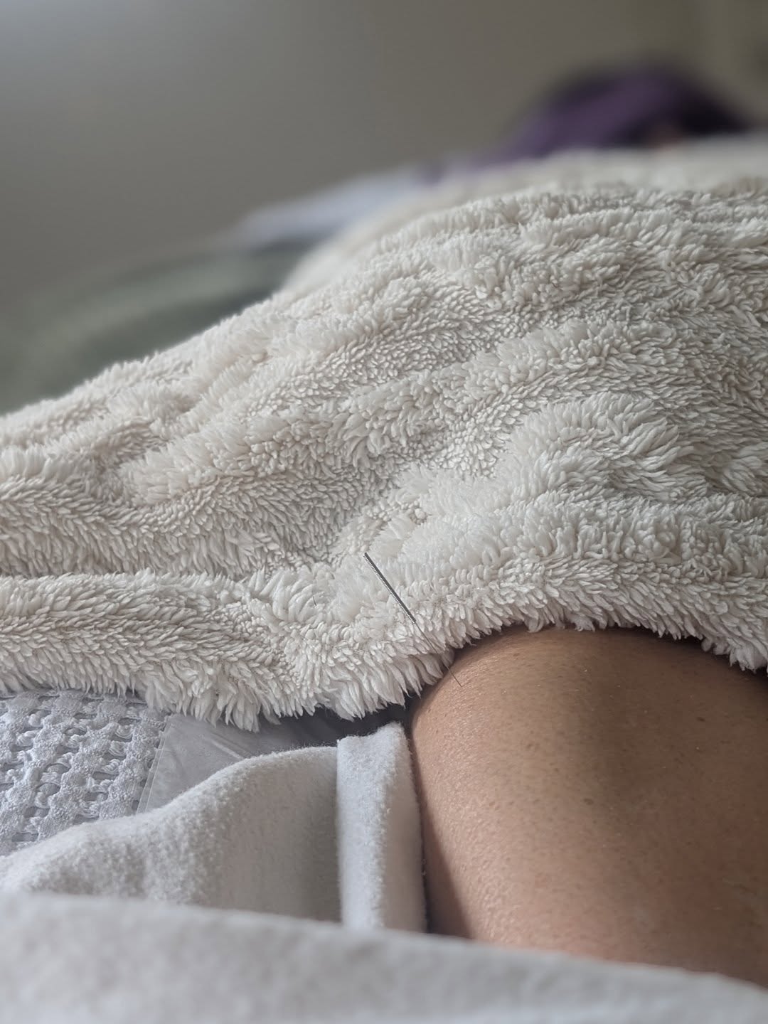 Not often I share my work outside of fertility āØ
This client came to me post-menopause, struggling after HRT left her feeling worse. We began a course of acupuncture treatments with some clear priorities:
š„ Hot feet
š”ļø Hot flashes & night sweats
š“ Fatigue
𤧠Sinus issues
Fast forward 6 sessions ā her symptoms have improved incredibly. She still wakes a couple of times at night (likely heat-related), but the difference in her day-to-day is huge.
A powerful reminder of what these teeny needles can do āØ
#AcupunctureWorks #MenopauseSupport #HolisticHealth #PostMenopause #AcupunctureBenefits #NaturalMedicine #WomensHealth #HotFlashes #NightSweats #EnergyRestored