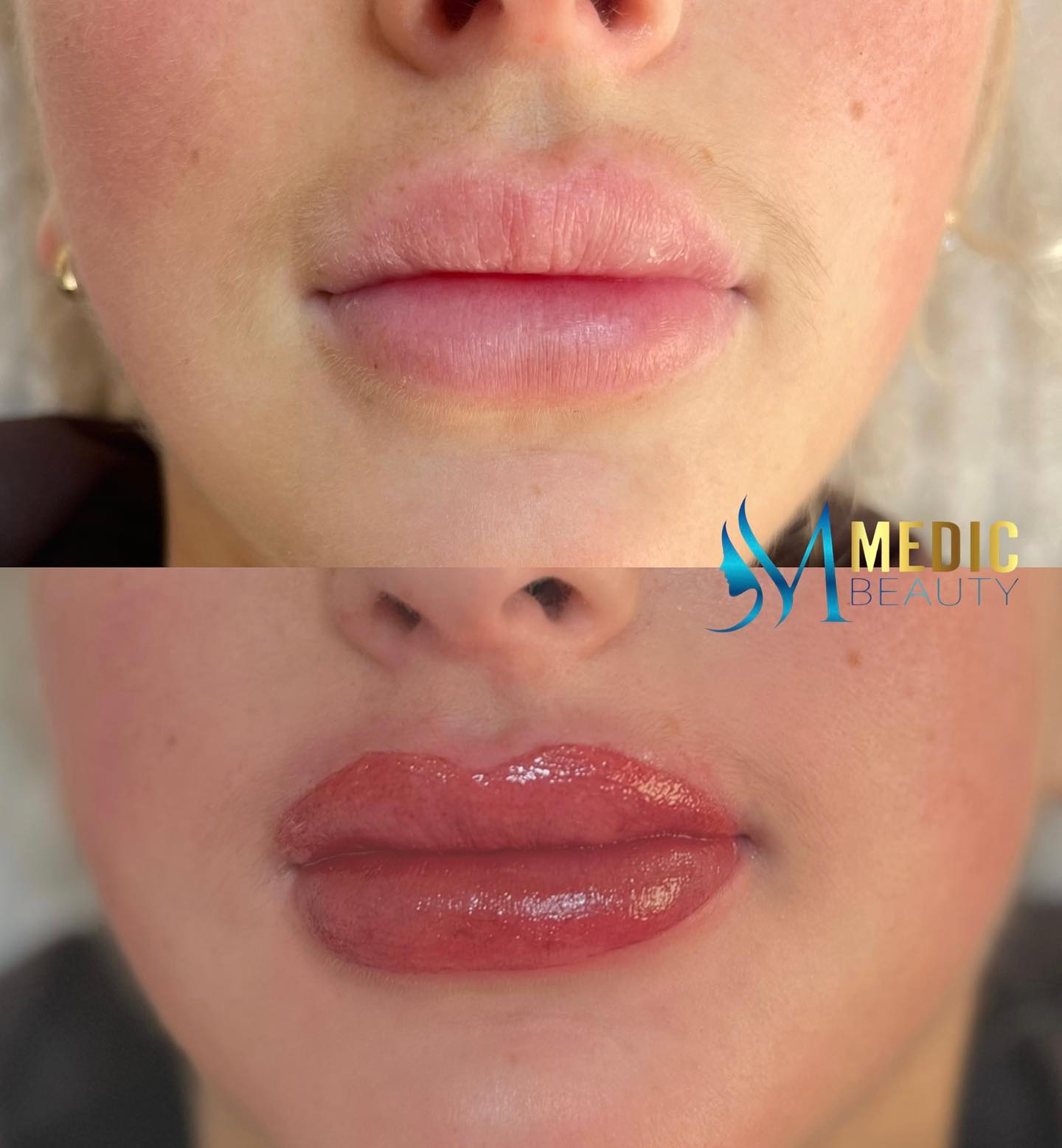 Läpptatuering 💋Dagens vackra kund som idag önskade:
- Framhäva sin egna läppkontur
- Få lite mer färg
✅chek & chek😍
#liptattoo #läpptatueringborås #boråsstad #skönhetklinik