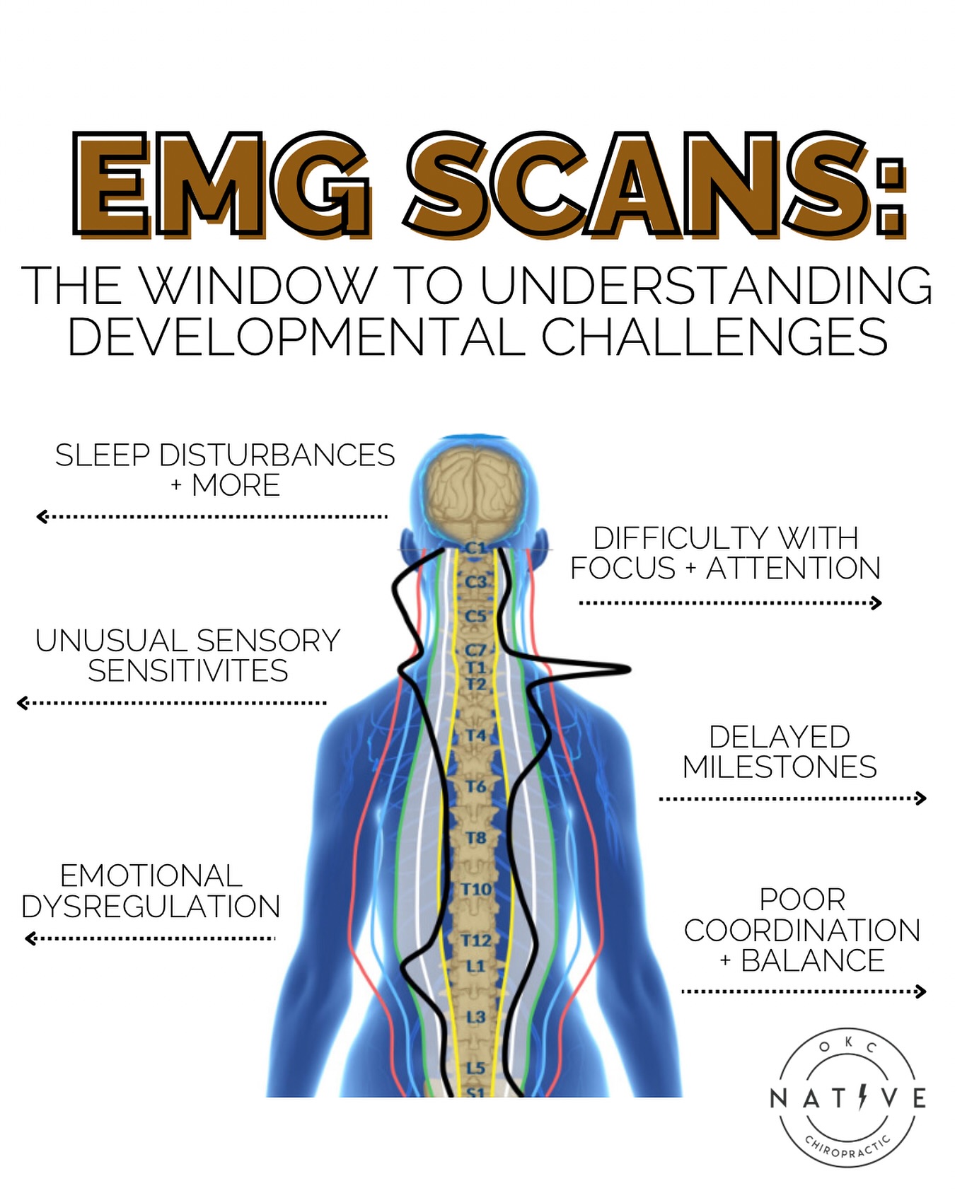 As parents, we know the early years are crucial for our children’s brain and nervous system development. But what if your child’s development seems off track, or you notice unusual behaviors that don’t resolve on their own? 🤔
Often, traditional medical assessments miss the critical role of neurological function in a child’s development. 📈 Concerns about colic, sleep challenges, meltdowns, or missed milestones are frequently brushed off, leaving parents feeling dismissed and without answers.
At Native Chiropractic, we use a revolutionary tool called INSiGHT EMG, providing a detailed window into your child’s neurological health. These scans detect patterns 📊 of tension, energy imbalances, and miscommunications that might be holding your child back from thriving.
The nervous system is like a superhighway of information, transmitting messages between the brain and body. When this communication system has glitches, it can lead to:
🚫 Delayed milestones
🚫 Sensory sensitivities
🚫 Emotional dysregulation
🚫 Focus and attention difficulties
🚫 Poor coordination and balance
🚫 Sleep disturbances
How can scheduling your child for an INSiGHT EMG scan help? By pinpointing neurological miscommunications, these scans provide a roadmap for targeted interventions, optimizing your child’s nervous system function and unlocking their true potential.
Don’t let your concerns be dismissed. Give your child the best start on their developmental journey by learning more at the article in our link in bio 𝐈𝐍𝐒𝐢𝐆𝐇𝐓 𝐄𝐌𝐆 𝐒𝐜𝐚𝐧𝐬 𝐔𝐧𝐥𝐨𝐜𝐤 𝐘𝐨𝐮𝐫 𝐂𝐡𝐢𝐥𝐝’𝐬 𝐍𝐞𝐮𝐫𝐨𝐥𝐨𝐠𝐢𝐜𝐚𝐥 𝐏𝐨𝐭𝐞𝐧𝐭𝐢𝐚𝐥! ✨🧠
#pxdocs / #tantrums / #juvenileseizures / #ADHD / #SPD / How to calm my child down / pediatric chiropractic / baby sleep / chiropractic for kids / colic / tantrums / ADD / constipation / ODD / OCD / ASD #okc #oklahomacity #nervoussystem #nervoussystemregulation #pediatricchiropractic #yukonok #okcmoms #edmondok