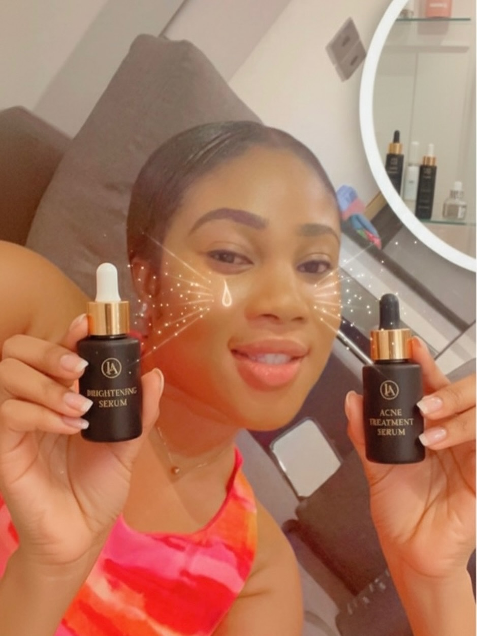 The best duo to tackle acne and hyperpigmentation, struggling to beat that face problems? Try our serums infused with oligopeptides, tranaxemic acid, alpha arbutin, hyaloronic acid, green tea, centella asiatica, Licorice extract, beta glucan and many more amazing ingredients… these are great tyrosinase inhibitors with barrier repair ingredients that are gentle yet tough on skin problems.. visit LuxeAuraglow.com to shop