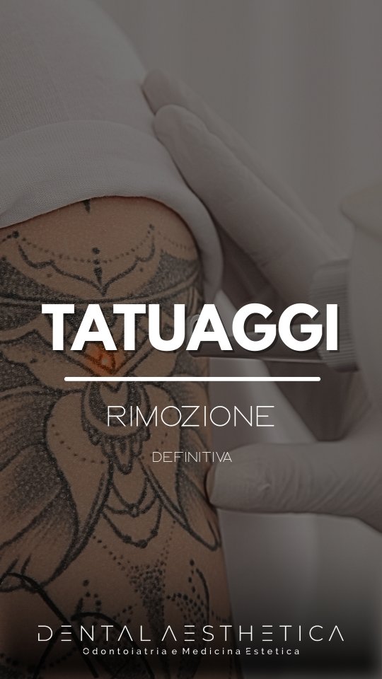 Perché un tatuaggio non sparisce al primo laser...ma a strati?
Ecco il principio che quasi nessuno ti spiega 👇🏻
🔫 Laser Q-Switched: effetto fotoacusico: frammenta il pigmento senza incisioni
🐉Valutazione personalizzata: protocolli su misura
🕝Schiarimento progressivo: il corpo smaltisce i frammenti tra una seduta e l'altra
🗣Condividi questo reel a chi vuole rimuovere un tatuaggio o scrivici nei commenti che tatuaggio hai e perché vorresti rimuoverlo!
#rimozionetatuaggi #roma #medicinaestetica #tattoo #ink #tatuaggi #tatuaggiroma