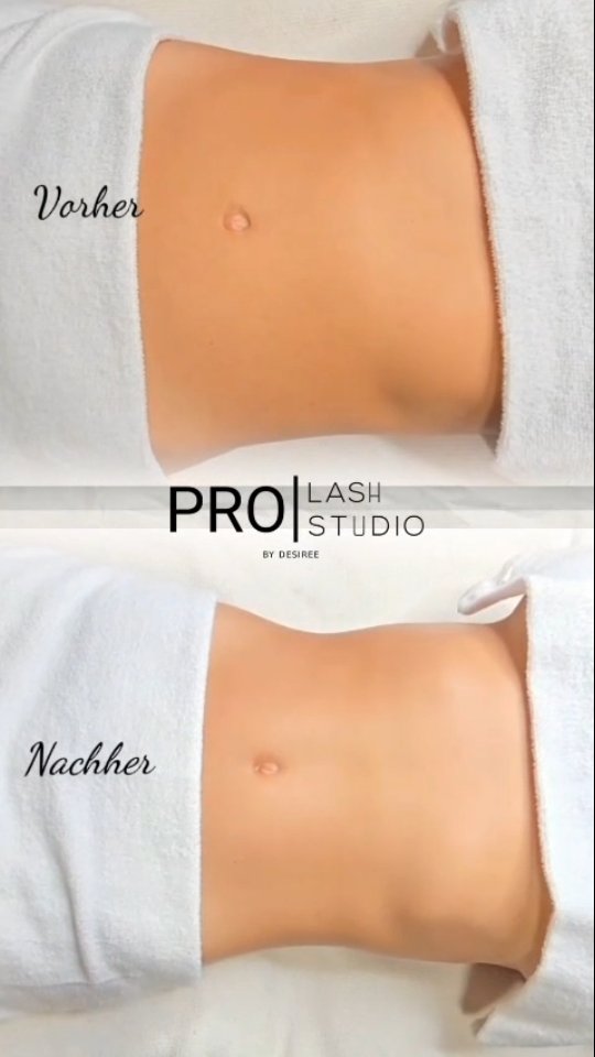 Das ist das Ergebnis nach nur EINER Sitzung! 😲
Und das ist erst der Anfang... stell dir vor, was eine komplette Behandlung bewirken kann! 💫
Manuelle Lymphdrainage + Körpermodellierung:
✔️Entstaut sofort
✔️Formt sichtbar
✔️Strafft die Haut
Bereit, deine Transformation zu starten?
📞Vereinbare JETZT deinen Termin mit Carla via
WhatsApp: +41 76 830 61 37
#WellnessGoals #Detox #BodyContouring #Lymphdrainage #FeelGood #thun #bern #lymphdrainagemassage #körpermodellierung #Bodyforming #Körperstraffung
#WellnessSchweiz #GesundheitSchweiz #AntiCellulite
#DetoxSchweiz #Selbstliebe #GanzheitlicheGesundheit #Schönheitstipps #massage #lymphaticdrainagetherapy #körperformung