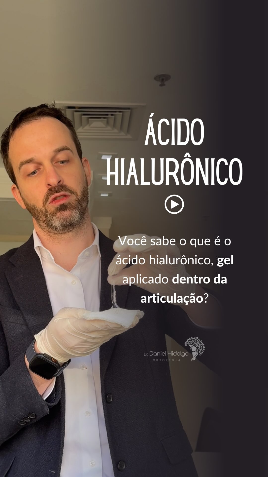💧 Você sabe como é o ácido hialurônico usado nas articulações?
No vídeo, mostro a aparência real do produto: um gel transparente e viscoso, que lubrifica nossas articulações. Esse tipo de ácido hialurônico é usado nas infiltrações do joelho para melhorar a lubrificação, reduzir a dor e tratar problemas da cartilagem, especialmente em casos de artrose ou desgaste.
#ÁcidoHialurônico #Joelho #Artrose #Ortopedia #SaúdeArticular #Infiltração #drdanielhidalgo
Dr. Daniel Hidalgo - Médico Ortopedista
CRM-SP 137.057 | RQE 41.112
Membro da Sociedade Brasileira de Ortopedia e Traumatologia (SBOT)
Membro da Sociedade Brasileira de Cirurgia do Joelho (SBCJ)