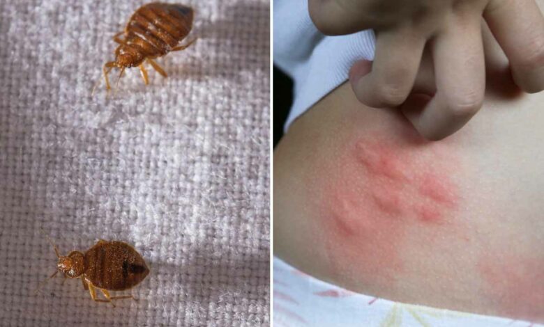 🐜 Les punaises de lit : un fléau qui revient en force !
Ces dernières semaines, les signalements de punaises de lit explosent dans toute la France.
Transports en commun, hôtels, cinémas, logements… personne n’est vraiment à l’abri 😬
👉 Le problème ?
Elles se déplacent facilement, se reproduisent très vite et leurs piqûres provoquent démangeaisons, stress et insomnie.
Et contrairement aux idées reçues, la propreté n’a rien à voir : même les lieux les plus impeccables peuvent être infestés.
🔎 Les signes qui doivent vous alerter :
- Démangeaisons au réveil, souvent alignées sur la peau
- Petites taches noires sur le matelas ou les draps
- Présence de petites traces de sang sur le linge de lit
- Odeur légèrement sucrée et désagréable dans la chambre
🚨 Que faire si vous suspectez des punaises de lit ?
Ne tentez surtout pas de traiter seul avec des produits du commerce : cela peut aggraver la situation.
Faites appel à des professionnels certifiés, équipés pour éradiquer totalement le problème.
Chez Solyservices, nous intervenons dans les 24h à 48h 7j/7 pour :
✅ Diagnostiquer la présence de punaises de lit
✅ Mettre en place un traitement efficace et durable
✅ Vous conseiller pour éviter toute réinfestation
📞 Contactez-nous dès les premiers signes d’infestation — plus vous agissez tôt, plus le traitement est simple et rapide !
Demander votre devis gratuit dès maintenant sur :
Site : Solyservices.com
Tel : 04 37 22 62 90
Nb : Nous intervenons sur tout le Rhône, l'Ain, l'Isère, la Haute-Loire, Saint-Etienne (42) et Mâcon (71).
#PunaisesDeLit #Hygiène #Santé #Prévention #Désinsectisation #HabitatSain #BienÊtre #Conseil