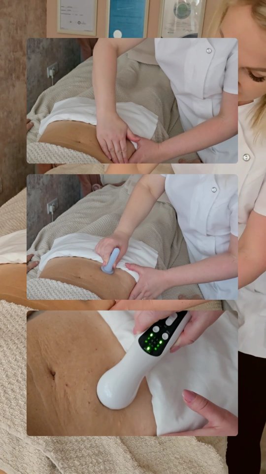 Did you know scar tissue isn’t just skin-deep?
It can affect how you move, how your skin feels, and even how connected you feel to your body.
Scar therapy helps:
✨ Release tightness and restriction
✨ Improve circulation and mobility
✨ Soften tissue and reduce discomfort
✨ Restore body awareness and confidence
You can usually begin scar therapy from 8 weeks post-surgery, once your incision has fully closed and healed. Every gentle touch supports your recovery — inside and out. 💛
Ready to start your scar healing journey?
📅 Book your session via the link in bio or send a DM to schedule.
#ScarTherapy #HealingTouch #ScarRecovery #restorescartherapypractitioner #HolisticHealing #PostSurgeryCare #WellnessJourney #ScarMassage #tissuerecovery #tatjanasenkova #MLDuktherapists