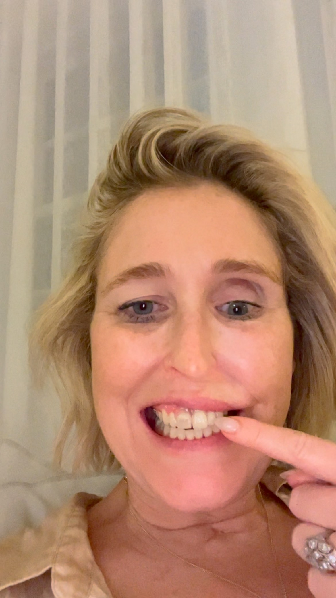 “I don’t like having a denture”
Well news flash Susak, that is probably how that fine set of curated teeth are gonna feel about you if you don’t shift your mindset!
I found this funny video I sent to my mum a few weeks ago when I was giving one of the denture versions a run privately at home. We made loads of versions before we hit the final one to parade in public settings.
Our physical bodies are a direct print out of our thoughts of yesterday, I firmly believe that.
How did I think I was going to nail this 8 year long battle with a prosthetic device designed to fit a mouth that is so reconstructed its almost a fictitious place with this kind of mindset about all that is lacking with it?
Yesterday, I cannot lie, the courage it took to go to work with it was of sizeable proportions. Did I rip it out in the middle of one meeting where I just couldn’t get my point across fast enough without ulcerating my tongue wildly? Yes, I did!
But did I focus all day on the myriad of positive news there was in the enormous progress we had made after many long years and failed attempts? Also, yes!
It makes a difference. Whether you think you can or you think you can’t, either way you are right. So, I kick on. It is in again today and let’s just see how it goes. I literally have nothing at all to lose and everything to gain.
#courage #denture #cancer #teeth #mindset #reframe #tryagain #persistence #dontgiveup