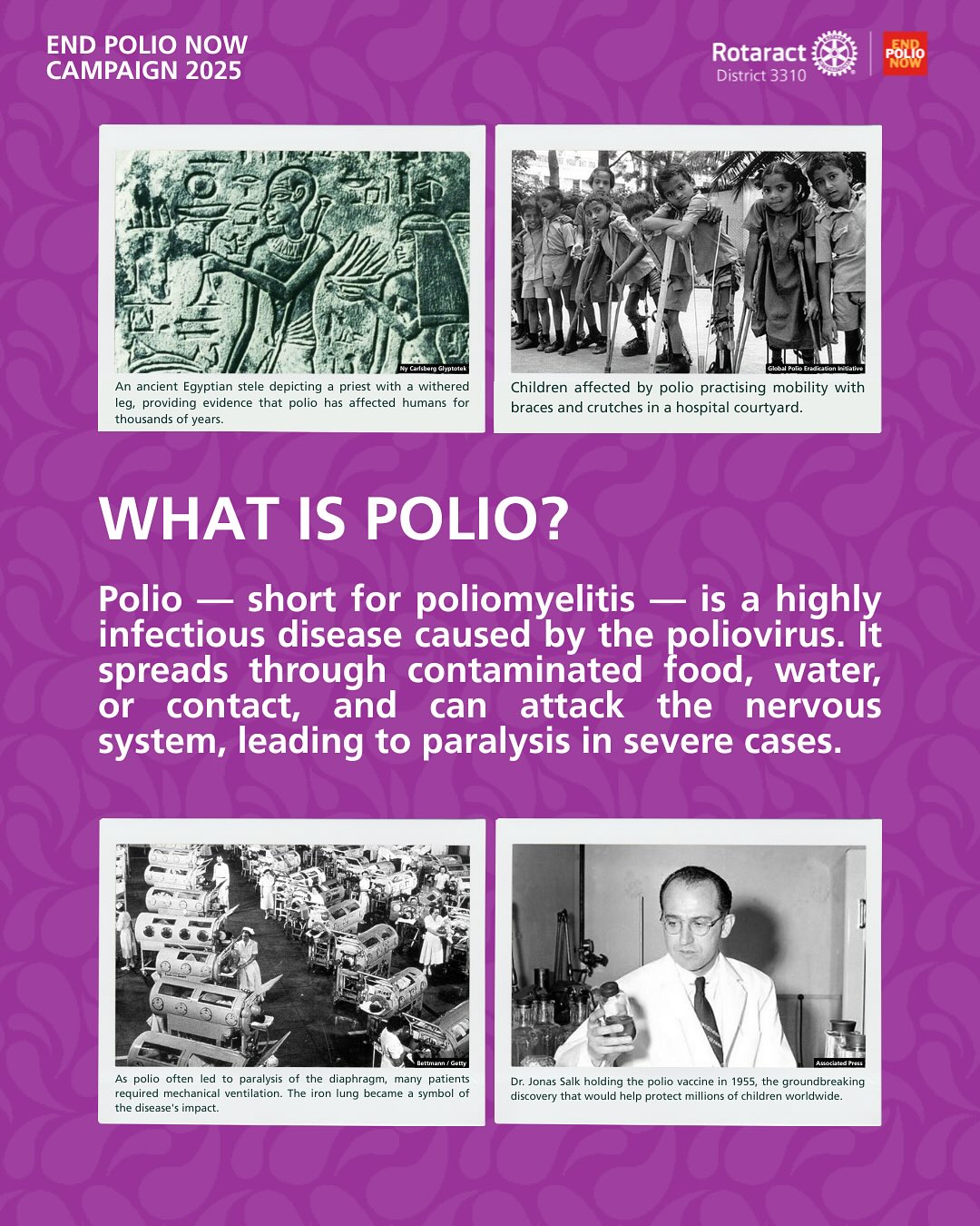 From fear to hope — the story of polio is one of resilience, compassion, and action.
Polio once paralysed hundreds of thousands of children every year. Thanks to decades of dedication by Rotary International and global partners, cases have been reduced by over 99.9% — and we are closer than ever to ending this disease for good.
Through ongoing vaccination drives, awareness campaigns, and fundraising efforts, Rotary International continues to lead the fight to protect every child, everywhere.
Together, we can make history — and create a future where no child suffers from polio again. 💉🌍
You can learn more by visiting www.endpolio.org or donate to www.my.rotary.org/en/polioplus-fund
#Rotaract3310 #UniteForGood #BecomingMoreThroughService #EPN #EndPolioNow #PurpleWeek3310