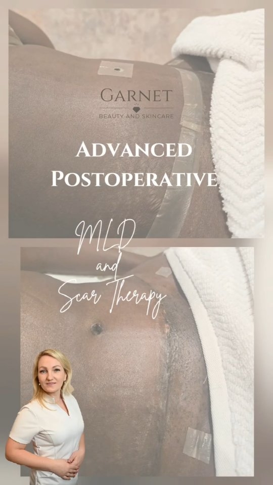 ⚕️ Advanced Postoperative MLD – The Science of Healing Beautifully ⚕️
After surgery, your body works hard to repair, detoxify, and restore balance.
But when lymphatic flow is disrupted by swelling, fluid build-up, or trauma to the tissues, recovery can slow down.
That’s where Advanced Manual Lymphatic Drainage (MLD) plays a crucial role. 🌿
This specialised technique uses gentle, rhythmic movements to:
✨ Stimulate lymphatic circulation and boost immune response
✨ Reduce postoperative swelling, bruising, and inflammation
✨ Prevent fibrosis and hard tissue formation
✨ Promote oxygen and nutrient delivery to healing tissues
✨ Improve scar appearance and overall skin texture
✨ Support comfort, mobility, and body symmetry
Each session is tailored to your specific procedure, healing stage, and body response — making it a vital part of any effective postoperative care plan.
This isn’t just a massage — it’s a medically informed therapy that helps your body heal faster, feel lighter, and reveal your best results sooner. 🌸
💫 Support your recovery. Honour your body. Heal with intention.
📩 DM or click the link in bio to book your Advanced Postoperative MLD session and start your guided healing journey today.
#PostOpCare #ManualLymphaticDrainage #AdvancedMLD #SurgicalRecovery #HealingJourney #BodyHealing #FibrosisPrevention #AestheticAftercare #ScarManagement #GarnetBeautyAndSkincare #TatjanaSenkova