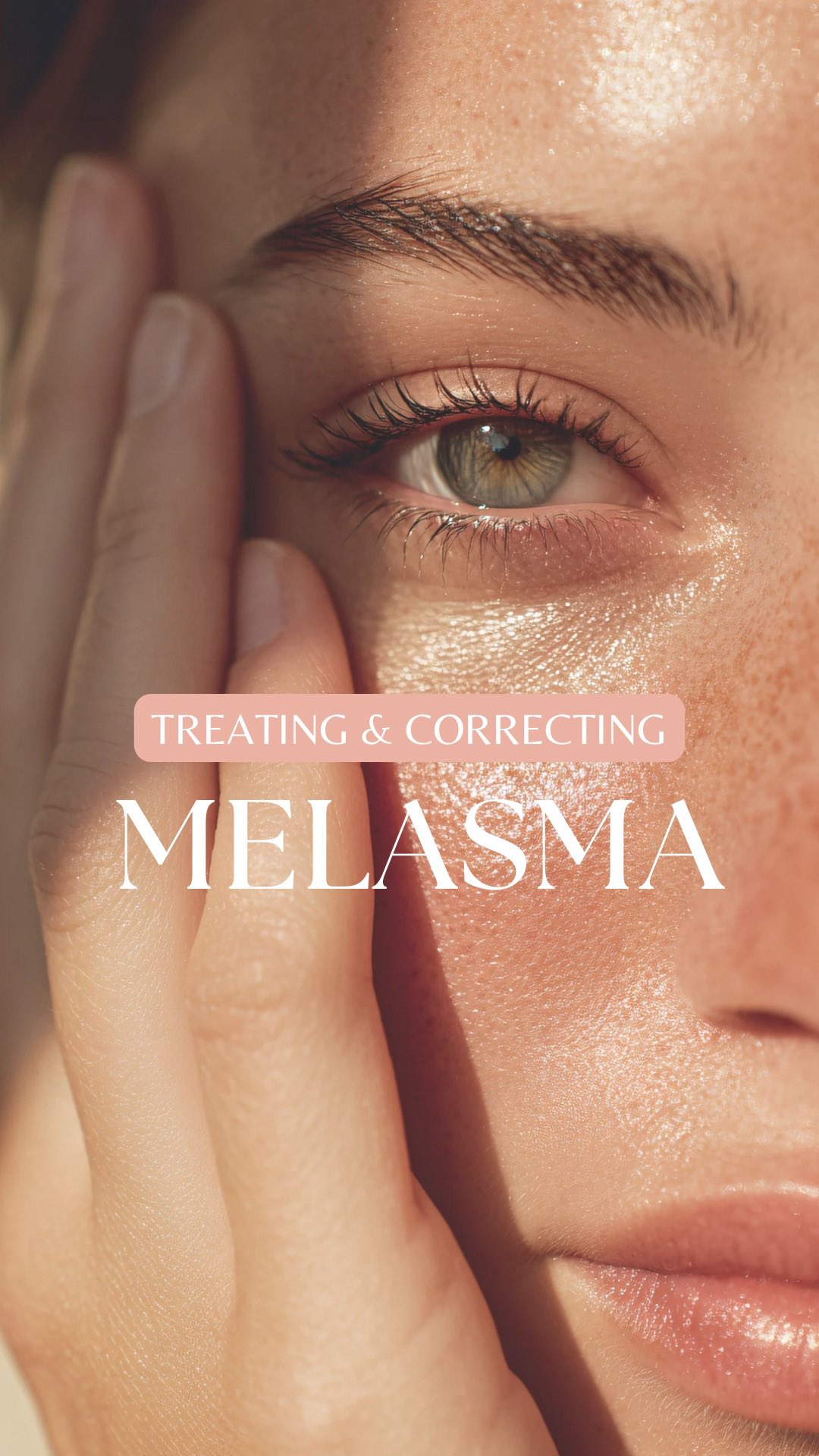 Correcting and treating pigmentation is really not 1,2,3 …
It takes a-lot of understanding on how to skin works, responds and what the next steps will need to be.
A skin that is in a unhappy state will not respond well compared to a healthy skin. This is why professional help is adviced, but educating yourself - some help will just make it easier.
‼️Here’s what some key ingredients do:
🔴Mandelic Acid → gently removes dead skin cells and brightens without irritation.
🔴Lactobionic Acid → ultra-gentle exfoliant that hydrates and smooths.
🔴Phytic Acid → helps prevent new dark spots and protects against environmental damage.
🔴Retinol → speeds up skin renewal and improves texture.
🔴Salicylic Acid → clears clogged pores and reduces post-acne marks.
🔴Lactic Acid → gently exfoliates while keeping skin soft and hydrated.
🔑The key: Concentration, formulation, and combination matter. That’s why professional, science-backed products lare so important — they’re tried, tested, and designed to work safely with your skin.
Consistency + professional guidance = results
❤️ Give a double tap, next up, we are looking at preventing and managing melasma
#SkincareScience #Hyperpigmentation #MelasmaCare #HealthySkin #pHformula #BrightSkin