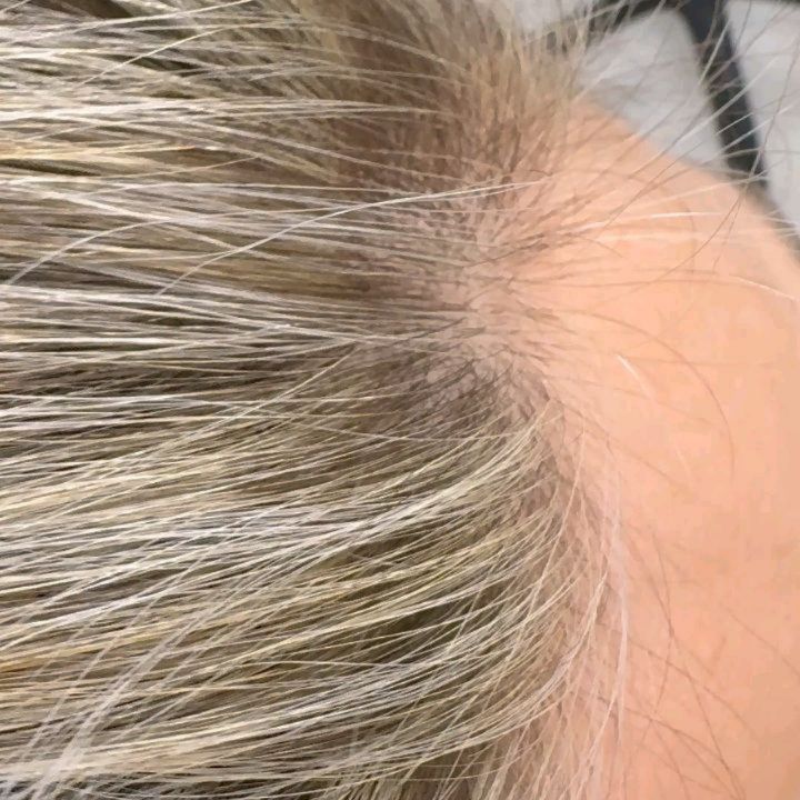 ✨ LE MECHES NON SONO TUTTE UGUALI ✨
Un’applicazione precisa fin dalla radice fa la differenza!
Lavorare con cura permette una ricrescita più naturale, una maggior durata del colore e un effetto luminoso che valorizza tutta la chioma.
Ogni passata di decolorazione viene studiata e applicata per rispettare il capello e ottenere un risultato armonioso 🌿
📍Dettaglio importante: radice pulita, sfumatura perfetta = ritocco meno frequente e più bellezza nel tempo!
In sinergia, l’utilizzo della nostra linea Nutriente firmata Tricovitalab:
🌱 Formule naturali, senza SLES e SLS, create per nutrire in profondità, lenire la cute e proteggere il capello anche durante i trattamenti chimici.
🧴 Tricovitalab nasce da un’attenta ricerca per offrire prodotti professionali che coniugano performance, sicurezza e rispetto per i capelli.
Il risultato? Capelli sani, forti e visibilmente più belli, dalla radice alle punte.
#schiaritureprotette #CapelliLuminosi #TricovitaLab #HairCareNaturale #capellisanieforti #senzasls #senzasles #ProdottiNaturali #curadelcapello #MechesPerfette #biondiluminosi