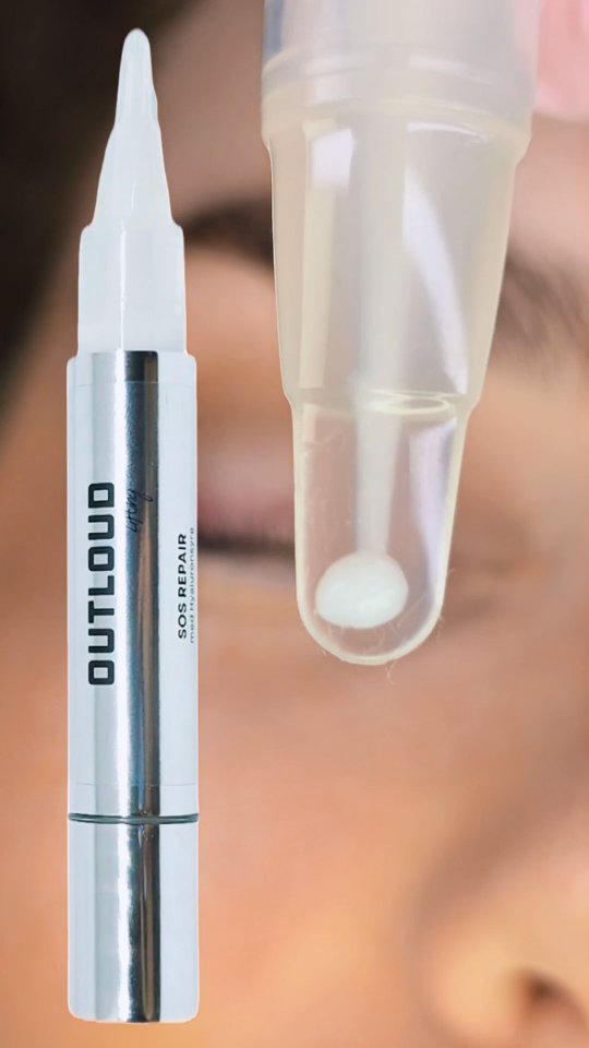 Kender du det, når vipperne ser lidt tørre eller krøllede ud efter et lash lift?
Det skyldes ofte, at vippehårene mister fugt under behandlingen – men løsningen er heldigvis enkel: SOS Repair! 💧
Den kan bruges som sidste step i behandlingen og er fyldt med hyaluronsyre, der binder op til 1000 gange sin egen vægt i fugt.
Resultatet? Bløde, glatte og glansfulde vipper – helt uden tørre spidser ✨
Den er også perfekt som aftercare-kur, du kan sælge med hjem til kunden til pleje mellem behandlingerne 💕
#SOSRepair #LashLiftCare #LashLiftAftercare #HealthyLashes #LashTreatment