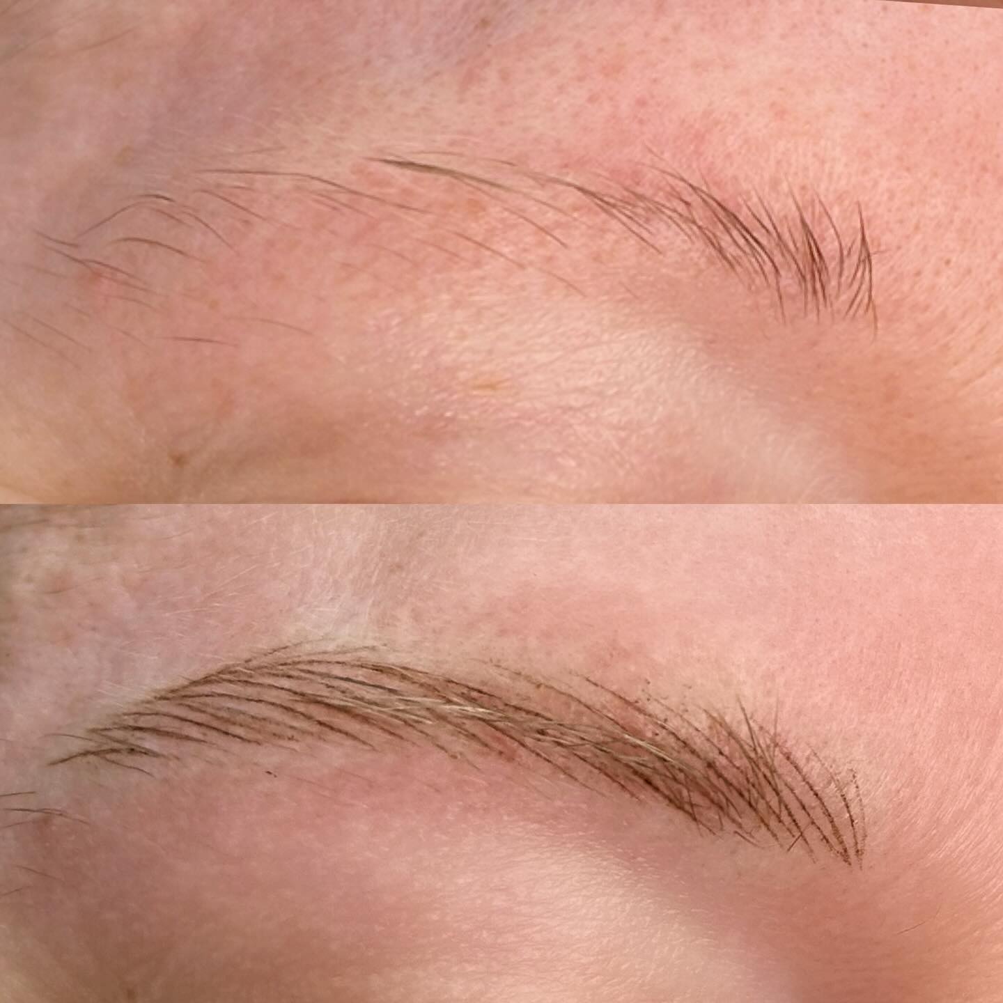 Game changing brows for this lovely lady ✨
This style of brows requires 1-2 Yearly Maintenance appointments and best suited to normal - dry skin types. I don’t recommend hairstrokes if you have previously tattooed brows x
#nanohairstrokes #invercargill #cosmetictattoo #notmicroblading #browspecialist #nzpmuartist #nzpmu #machinebrows