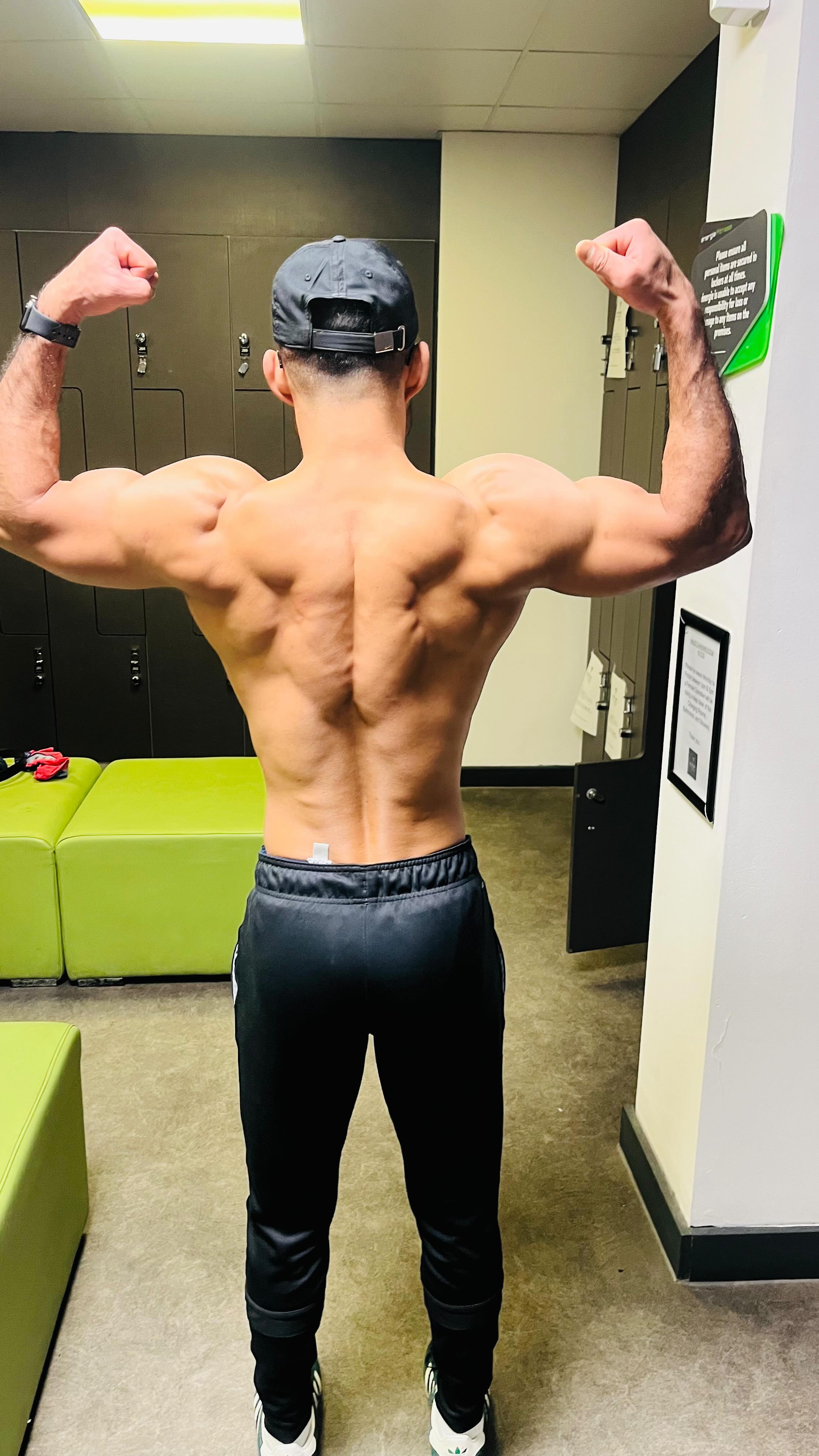 In my 20s, I could train however the fuck I wanted.
High volume. No structure.
Miss sleep, still hit PBs.
But your body doesnโt lie in your 30s.
All that โjunk volumeโ you could recover from before?
Now it just lingers in your joints, your nervous system, your sleep.
So I had to evolve how I train.
Still heavy. Still intense.
But smarter, built around neural drive, joint health, and performance longevity.
Thatโs where heavy banded squats come in.
They load the body where youโre strongest and deload where youโre most vulnerable.
Less shear force at the knees and hips.
More top-end tension for the glutes, quads, and erectors.
You train the force curve, not just the movement.
The bands force constant acceleration, so youโre not just lifting, youโre training your CNS to fire harder and faster.
That means better rate of force development, motor unit recruitment, and power output without trashing your recovery.
Iโve never trained just to get bigger.
Iโve always trained to look absolutely fucking jacked, fast, and strong.
Like my body could perform under pressure, not just look good under lights.
Thatโs the difference between aesthetic muscle and functional dominance.
You donโt need more volume.
You need better intent.
Smarter stimulus.
Cleaner recovery.
Train your nervous system, not your ego.
Thatโs how you stay powerful in your 30s, 40s, and beyond.
If youโre in your 30s and want the exact system I use to stay strong, lean, and injury-free,
drop โBlueprintโ in the comments.
Iโll send you a free copy of my 30s Performance Blueprint, built for busy men who still want to lift heavy, move fast, and look fucking elite.