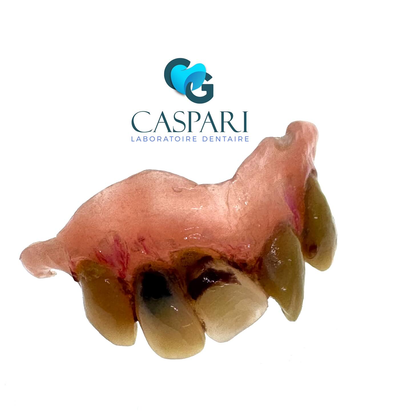 Epitheses et dents sur mesure pour effet d’enfer 🧌tout est réalisable et réutilisable sur plusieurs années #halloween #surmesures #monstre #dentiermonstre #cinema #prothescinema #effetciné #maquillage defformationcorporelle #horreur #dental #dentvampire #dentmonstre