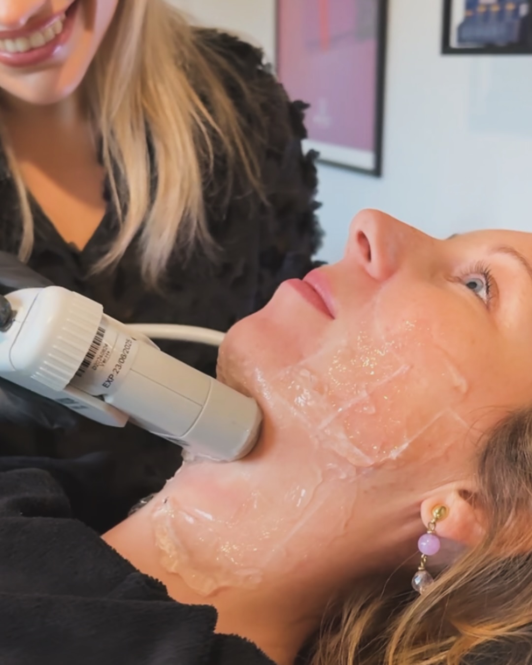 NATUURLIJKE LIFTING ZONDER INJECTIES! ✨
__________
Swipe en ontdek de prachtige resultaten van onze HIFU! 😍
Met gerichte ultrasone energie stimuleren we het collageen diep in de huid, waardoor de huid steviger, strakker en gelift wordt! Helemaal zonder hersteltijd of naalden.
HIFU verstevigt en lift je huid dus van binnenuit, zonder toxines of fillers. Geen onnatuurlijk effect hier, maar een frisse, gelifte versie van jezelf! 👏🏻
Ideaal bij:
•verslapping van de huid of kaaklijn
•fijne lijntjes en rimpeltjes
•verlies van contour of stevigheid
De resultaten spreken voor zich hé? 🤩
Wil jij ook weten wat HIFU voor jouw huid kan doen? Plan dan vandaag nog je gratis intakegesprek via de link in bio.
Veel liefs,
Paulien.
__________
💌 info@plusbelletheskinstitute.be
🛍 www.plusbelletheskinstitute.be/webshop
📱 0474/88.29.16
📅 Enkel op afspraak
🌎 www.plusbelletheskinstitute.be
📍 Oosterzele, België
________
#hifufacelift #natuurlijkelift #geenfillers #geentoxines #collageenboost #strakkerehuid #liftingzonderinjecties #onderkin #kaaklijnlift #huidversteviging #rimpelvrij #huidverslapping #natuurlijkeresultaten #facialcontouring #hifuresults #skinexpert #antiaging #jeugdigelook #noninvasivelift #plusbelle #oosterzele #hifu #fijnelijntjes #rimpels #collageen