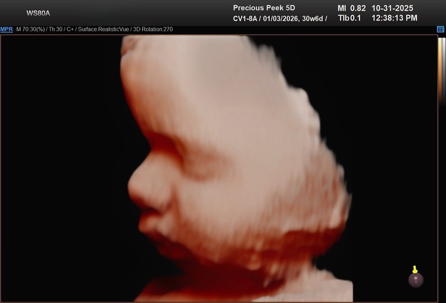 More than an ultrasound, it’s that first real moment
where it hits you: that’s my baby.
Before tiny fingers curl around yours,
Before that first cry echoes in the room,
You’re getting a front row seat to the little life growing and wiggling inside you.
Sweet profile, tiny hands, little kicks, your whole world, right on the screen ❤️