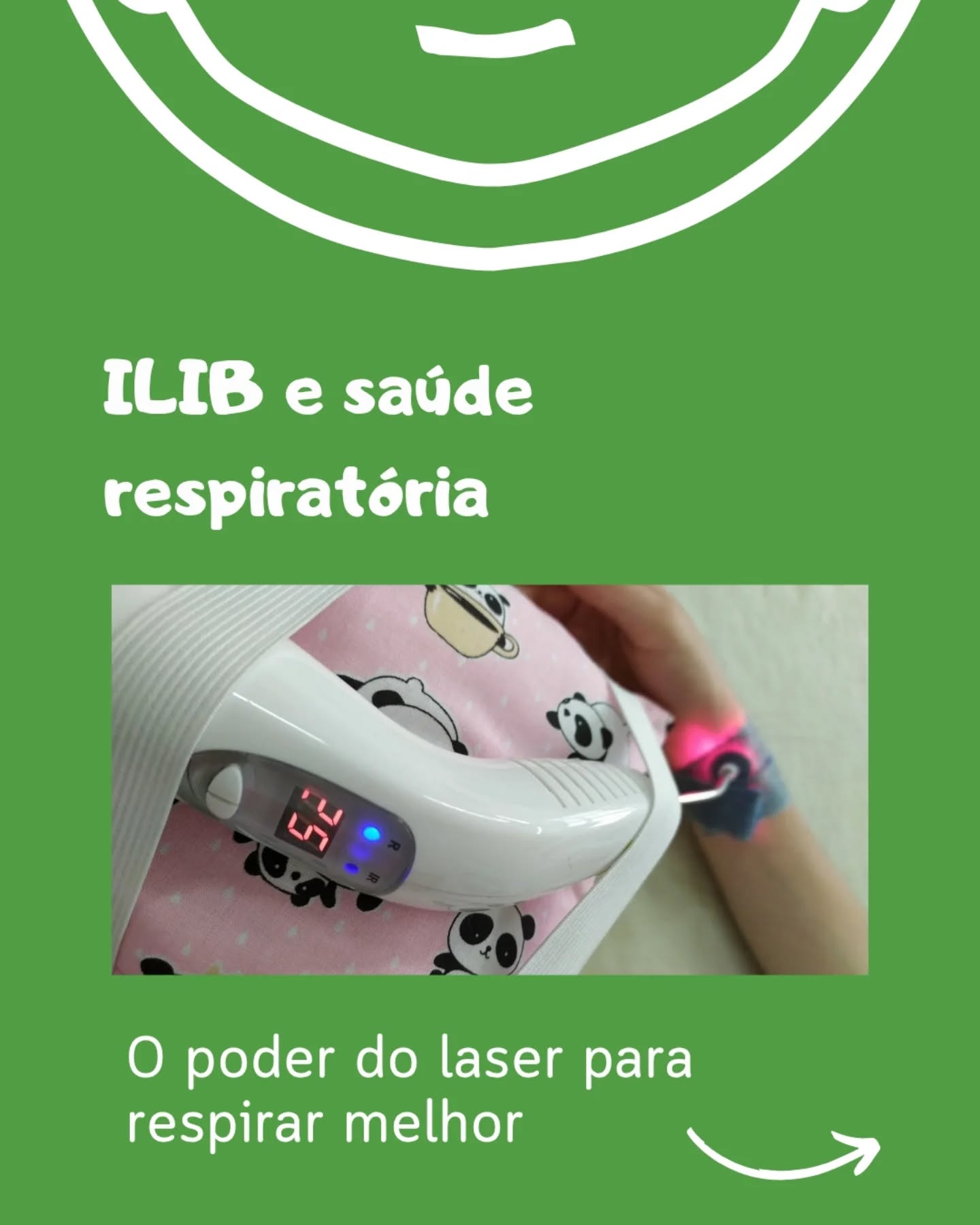 Você sabia que o laser também pode ajudar o nosso corpo a respirar melhor?
O ILIB (Irradiação Intravascular de Sangue com Laser) é uma técnica estudada desde os anos 1970 que usa luz de baixa intensidade para estimular o sangue e melhorar o equilíbrio do nosso organismo.
Pesquisas recentes indicam que o ILIB pode:
- Diminuir inflamações nas vias respiratórias
- Melhorar a oxigenação do sangue
- Ajudar na recuperação de doenças pulmonares
- Aumentar a energia e o bem-estar geral
O ILIB não substitui o tratamento médico ou fisioterapêutico, mas é uma terapia complementar segura e promissora, com base científica crescente.
Se o seu bebê sofre com crises respiratórias, secreções ou dificuldade para respirar, converse com nosso time.
O cuidado certo, no momento certo, faz toda a diferença!
Referências
Schapochnik A. Intravascular laser irradiation of blood (ILIB) used to treat lung diseases: a short critical review. Lasers Med Sci. 2023.
Benevento EM et al. Transcutaneous intravascular laser irradiation of blood: metabolomic study. Scientific Reports (Nature). 2024.
Meneguzzo DT, Ferreira LS, Carvalho EM, Nakashima CF. Intravascular Laser Irradiation of Blood. In: Handbook of Low-Level Laser Therapy. Pan Stanford; 2017.
Zhang X et al. Photobiomodulation attenuates airway inflammation in an asthma mouse model. Eur J Med Res. 2023.
Li J et al. Effect of ILIB as adjuvant therapy in pneumonia: clinical observation study. J Tradit Chin Med. 2021.
Yan S et al. Photobiomodulation in chronic obstructive pulmonary disease models: anti-inflammatory and antioxidant mechanisms. Front Physiol. 2022.
Review: Photobiomodulation systemic effects and clinical applications in respiratory diseases. Biomed Pharmacother. 2025.