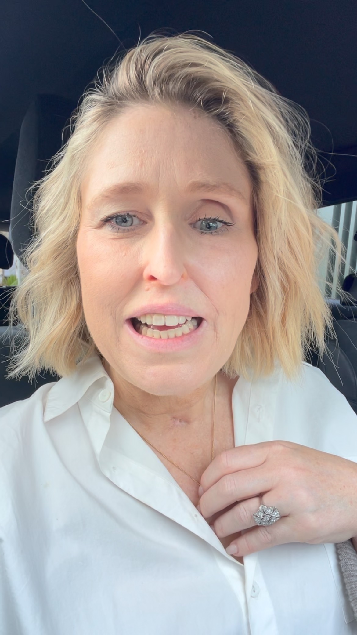 Meet Sarah with teeth 🦷😁
It may only be temporary. We don’t know if it will work. My new mouth doesn’t have a lot to hook a denture into.
But if I don’t share it publically then I may give up privately.
Because it’s hard. It’s hard to adjust physically and mentally.
It’s all a bit of experimentation. We don’t know if it will work, stay in, hurt me, be painful or difficult to speak or eat. But I’m ready to try.
It won’t always be in as I need to get used to it slowly and it may disappear all together and we restart the build. This is my 9th attempt. Little steps.
What do you think?
Big moment. Thanks to the divine man who saw my story in Daily mail and connected me to an able genius of a denture doctor! Dr Nicholas Ivey at Lane Cove Denture Clinic.
Living without teeth has been a huge part of my story. Read my book YOURU: Find the Guru within You and learn about how I managed and how I pulled through one of the most epic phases of my dear life.
You can buy it on www.sarahsusak/my-book
Thanks for all the love, acceptance and support for so many years now.
#teeth #denture #courage #try #experiment #cancer #survival #youru #book