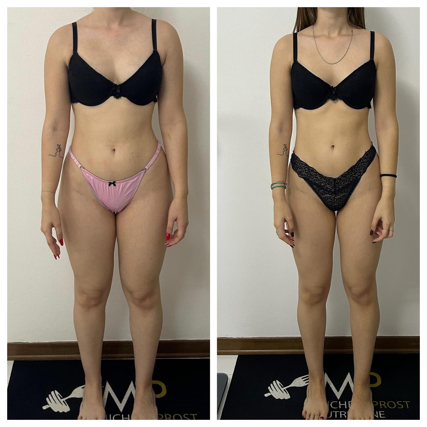 ⚠️⚠️⚠️work in progress!
Oggi vi mostro questo bel cambiamento iniziato a ridosso dell’estate in collaborazione con @sportewellness_studiopt di @gyo91
Arrivata da me per rimettere ordine nell’alimentazione si è subito messa a lavoro anche con la cura dell’allenamento.
In pochi mesi di ipocalorica ha ottenuto un ottimo risultato.
Ora si passa ad una fase di rialzo calorico per ottimizzare gli sforzi degli allenamenti.
Che dire? Bravissima 👏
Il buon connubio sport e alimentazione hanno dato i suoi frutti!!
#check #nutrizione #sportealimentazione #work #ricomposizionecorporea #fitness #nutrition #cagliari