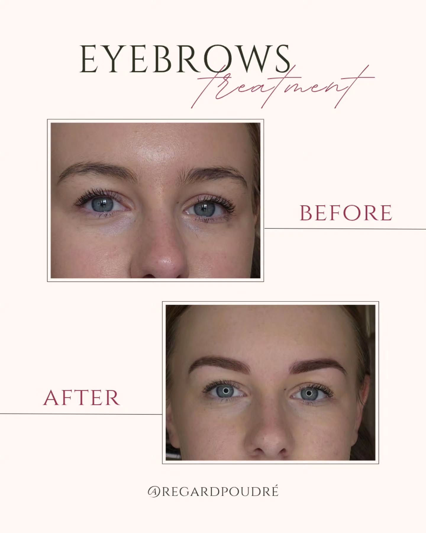 Maquillage permanent des sourcils 💉💞
Sourcils Poudrés 🤎
📍 Homblières (02720) — salon privé, sur RDV uniquement
🗓️ Ouvert du lundi au samedi matin (non-stop le midi)
🔗 Tarifs, descriptions et reservations (Planity) : https://www.planity.com/regard-poudre-02720-homblieres
📲 📞 06 49 57 28 05
#powderbrows #sourcilspoudrés #pigmentationsourcils #maquillagepermanent #maquillagesemipermanent #dermopigmentation #esthetique #homblieres #aisne #hautsdefrance