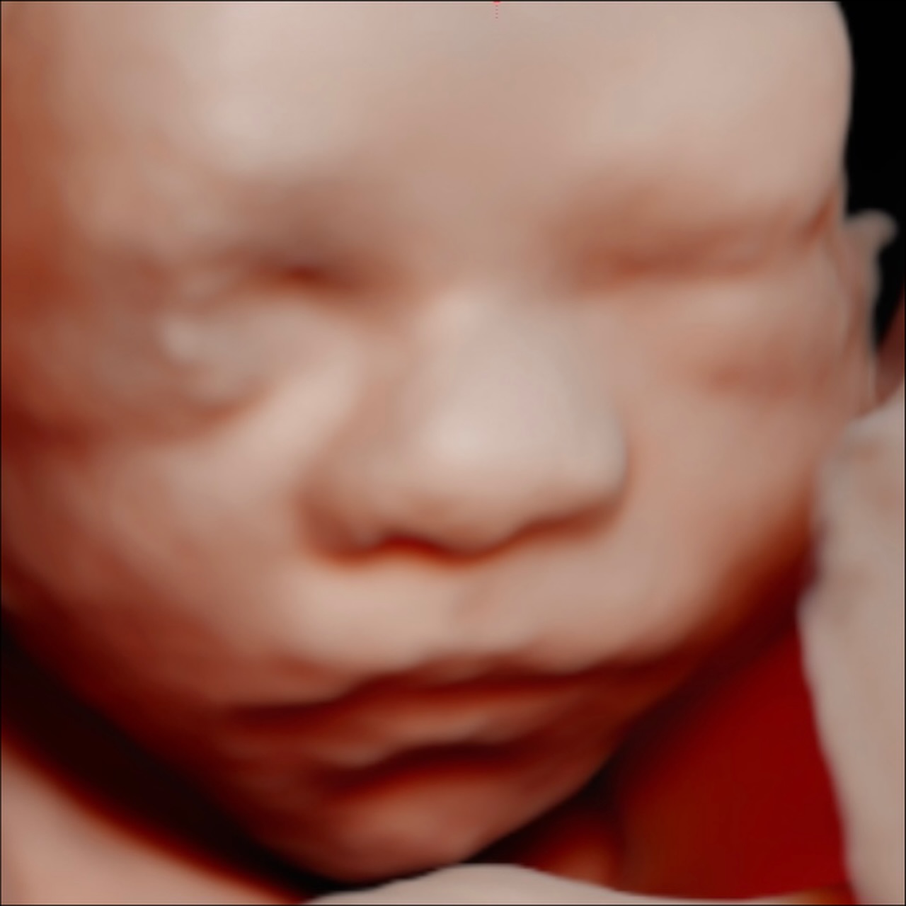 swipe to see baby boys eyes open and foot on his head 😅😍