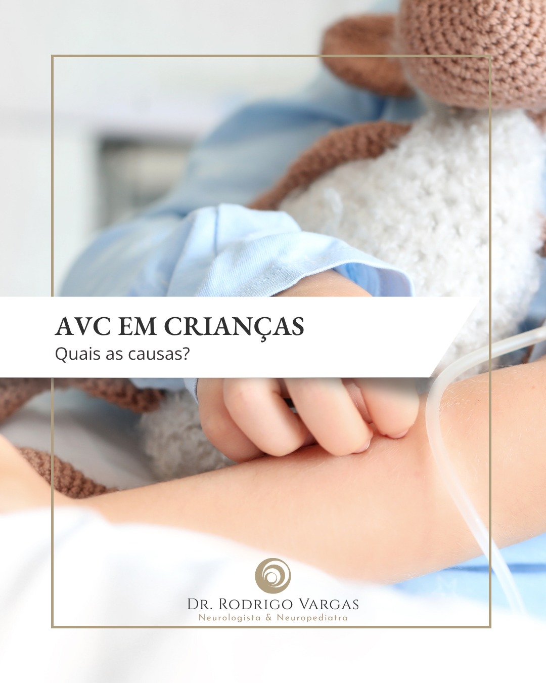 🧠🚨 Quais as causas do AVC em crianças?
Embora menos comum do que na população adulta, o Acidente Vascular Cerebral (AVC) é uma realidade na infância e é a 10ª principal causa de mortalidade em crianças.
Segundo a American Heart Association (AHA), a incidência é de cerca de 2 a 13 casos por 100.000 crianças ao ano.
As causas para o AVC infantil são muito variadas e diferem da população adulta, dentre as causas mais frequentes estão:
- Doenças cardíacas: como malformações congênitas, miocardite, doenças valvares e arritmias.
- Doenças Hematológicas: como a anemia falciforme e os distúrbios da coagulação (trombofilias).
- Infecções graves: como encefalite ou meningite.
- Doenças arteriais como a dissecação arterial e a doença de Moyamoya.
- Doenças vasculares que cursam com inflamação das artérias cerebrais.
- Diversas doenças metabólicas e genéticas.
Sinais de alerta de AVC em crianças:
- Fraqueza súbita ou paralisia em um lado do corpo (rosto, braço ou perna)
- Dificuldade para falar ou entender comandos
- Convulsões sem febre
- Sonolência ou perda de consciência
- Perda repentina da coordenação ou equilíbrio
O manejo dos fatores de risco reduz significativamente o risco de eventos cerebrovasculares em crianças.
🔎 Siga @rodrigovargasneuro
#AVCInfantil #Neuropediatria #SaúdeCerebral #DoençasNeurológicas #DrRodrigoVargas #NeurologiaPediátrica #AVCEmCrianças #PaisBemInformados