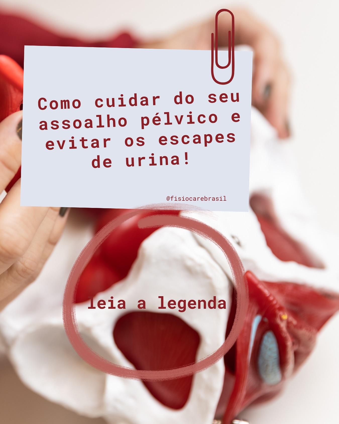Você sabia que pequenas atitudes no dia a dia podem proteger o seu assoalho pélvico e evitar aqueles escapes de urina ao tossir, rir ou fazer esforço?
👉 Aqui vão alguns cuidados simples e poderosos:
1️⃣ Evite “segurar o xixi” por muito tempo.
Isso aumenta a pressão sobre a bexiga e enfraquece a musculatura pélvica.
2️⃣ Não faça força para urinar ou evacuar.
O esforço repetido empurra o assoalho pélvico para baixo e pode causar flacidez e incontinência.
3️⃣ Fortaleça o assoalho pélvico.
Com exercícios guiados por uma fisioterapeuta pélvica, é possível reeducar a musculatura e recuperar o controle.
4️⃣ Cuide da sua postura.
A forma como você senta, tosse ou levanta peso influencia diretamente na saúde pélvica.
5️⃣ Respire corretamente.
A respiração e o assoalho pélvico trabalham juntos — quando você prende o ar, aumenta a pressão interna e sobrecarrega essa região.
✨ Evitar escapes de xixi começa com autocuidado, não com vergonha!😉
📲 Quer aprender mais? Eu ensino tudo isso de forma prática - presencial e online 😍