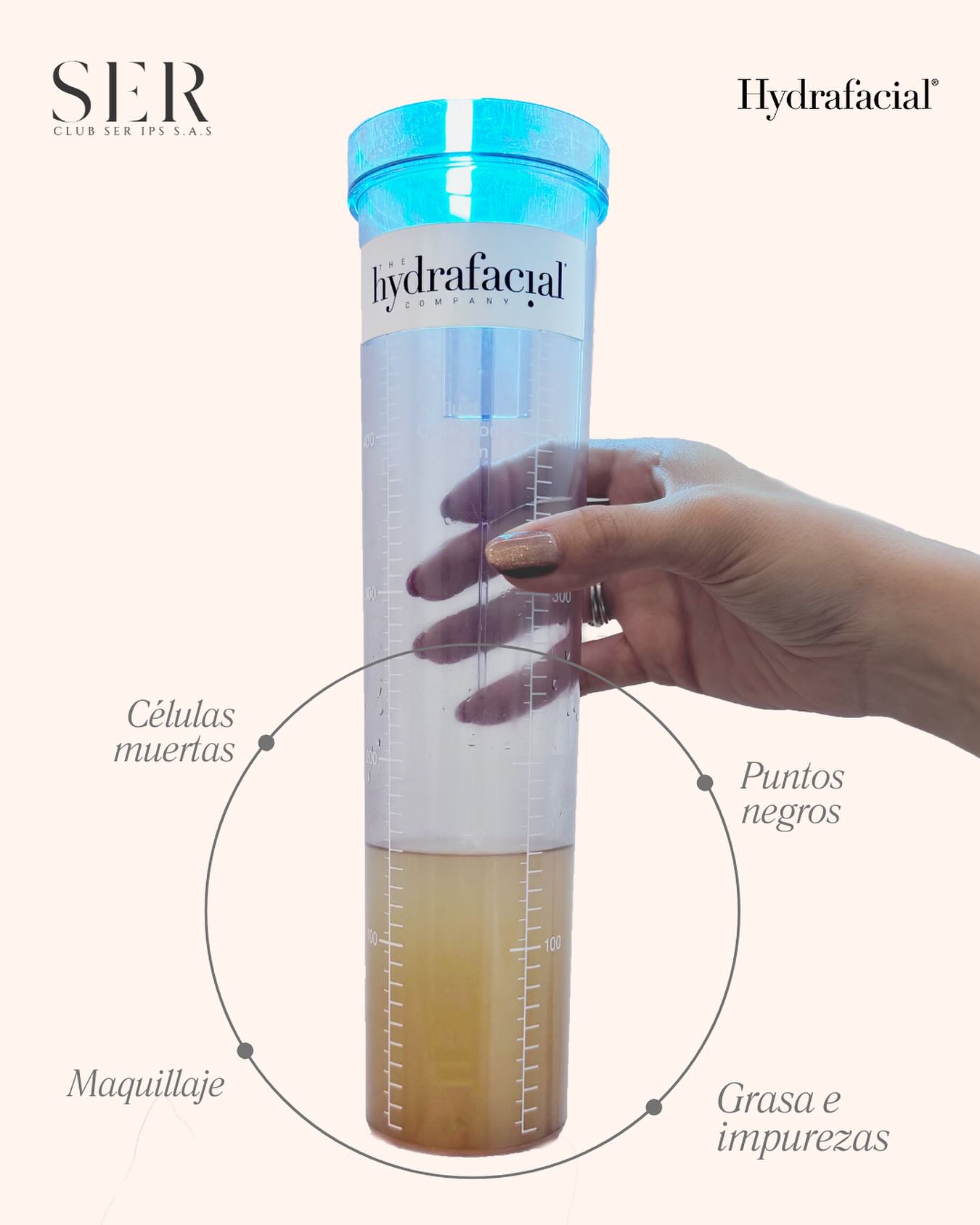 Esto es lo que queda después de un Hydrafacial. Células muertas, restos de maquillaje, puntos negros, grasa e impurezas.
Todo eso se acumula en la piel y es eliminado durante una sola sesión de Hydrafacial.
Este tratamiento realiza una limpieza profunda, exfolia, extrae e hidrata al mismo tiempo, dejando la piel visiblemente más limpia, fresca y luminosa✨
¿Listo para tener la piel que siempre soñaste, libre de impurezas y llena de vida?
Descubre la experiencia Hydrafacial Original en Club SER y regálale a tu piel el cuidado que merece
#Hydrafacial #limpieza #pielsaludable
