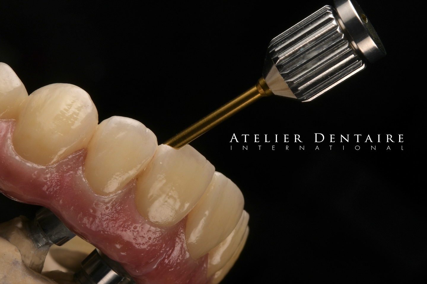 How’s the gingiva reproduction?
I tried using VINTAGE Art Universal Gum color.
・
・
・
・
・
・
@shofuinc_jp
@ivoclar
@atelierdentaire.international
@hirosaka_forestone
@uncsea
#fullarch
#zirconia
#gum
#dentallab #dentallaboratory #aestheticdentistry #morphology #frontteeth #smile #dentaltechnology #zahntechnik #stomatolog #odontologo #dentalveneers #fullmouthrehabilitation #dentalphotography #dentaltechnician #dentistry#shofudental #shofuvintage #shofuvintageartuniversal