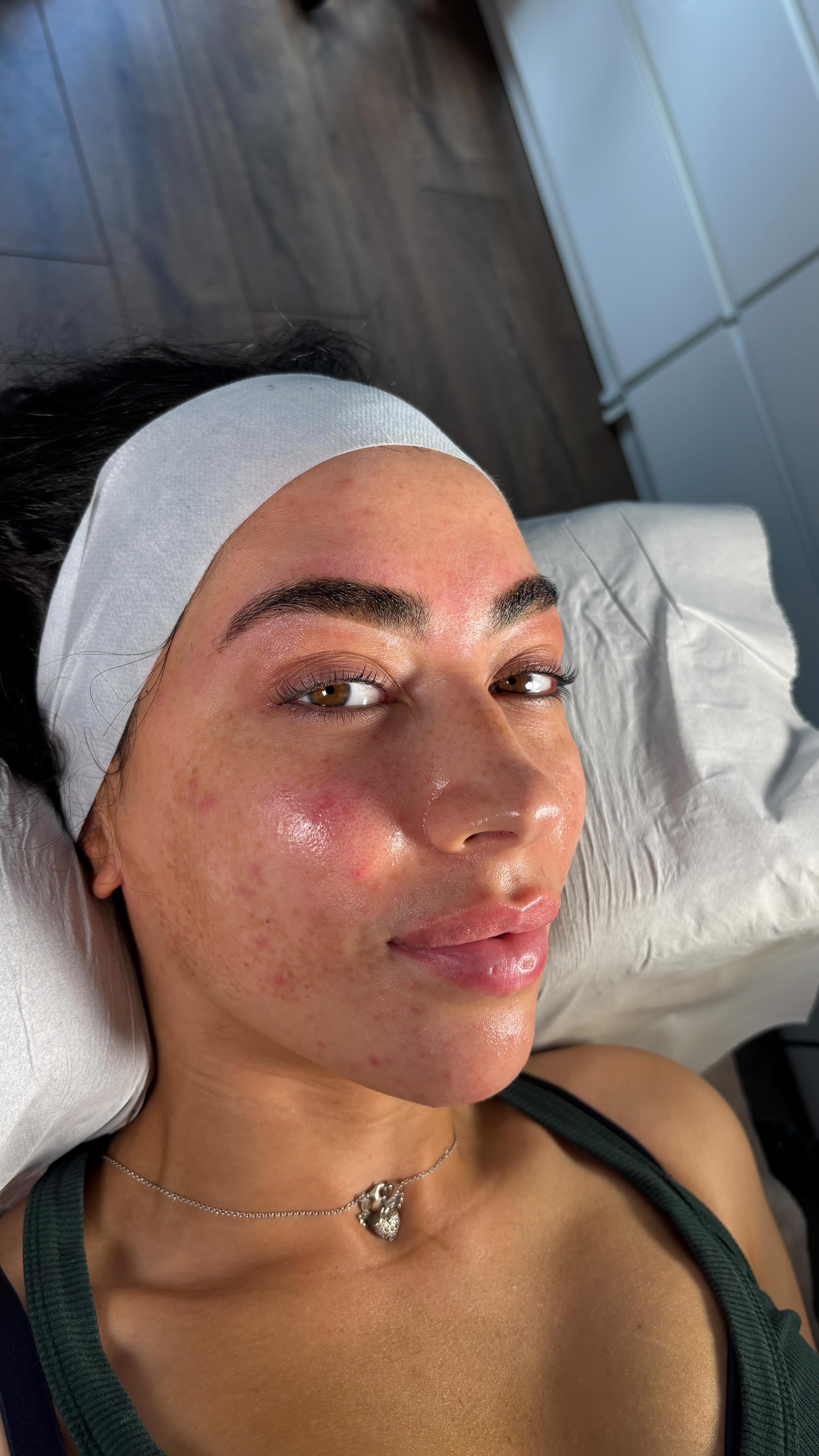 See those little teenie hairs? That’s what happens when you can’t resist the tweezers 🙈
Let your brows grow between appointments because if the hair’s too short, the wax can’t grab it, meaning uneven results and more tweezing being needed.
Patience = perfect brows 🫶🏽